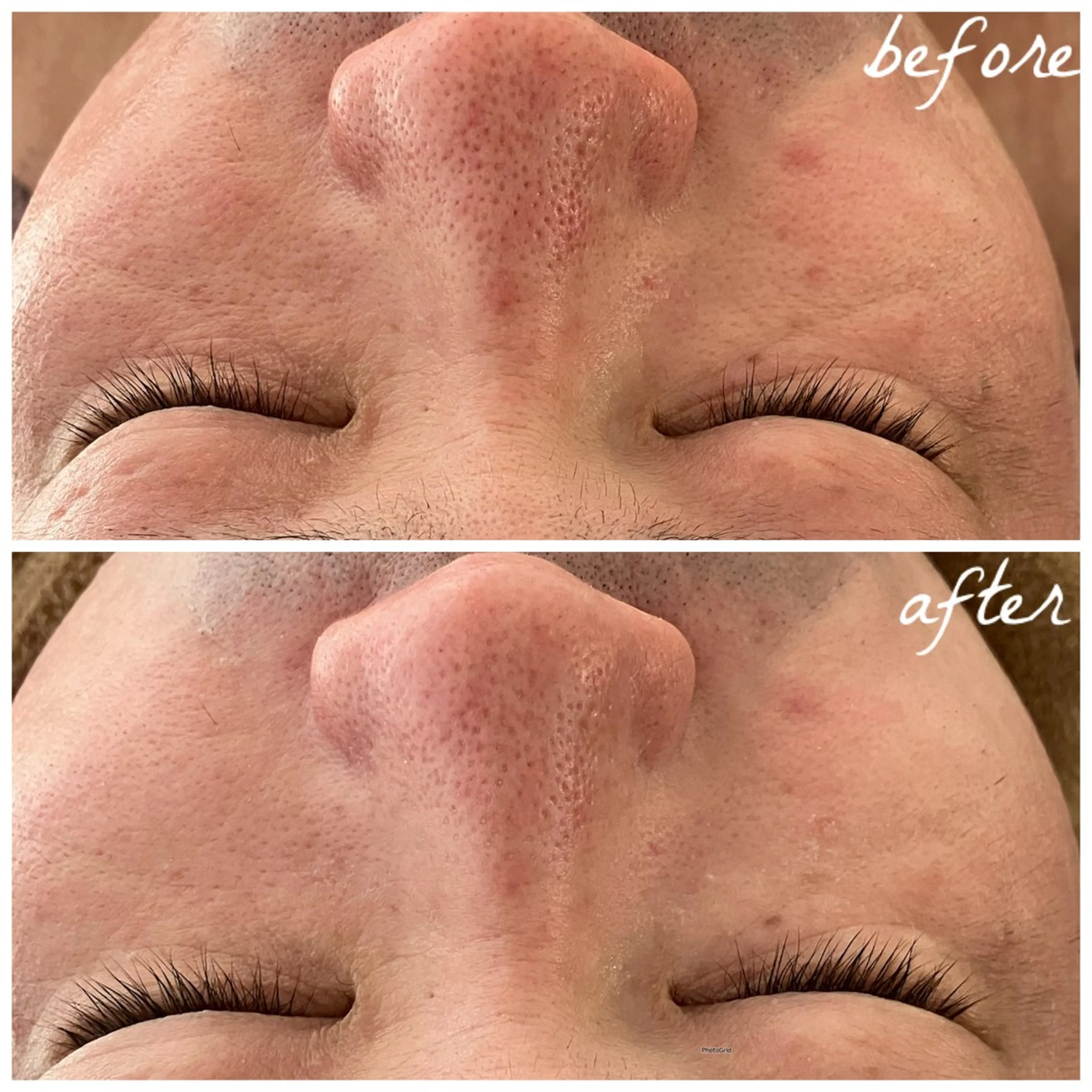 メンズ エステ メナード岐阜市茜部 杉浦のエステ・リラクイメージ