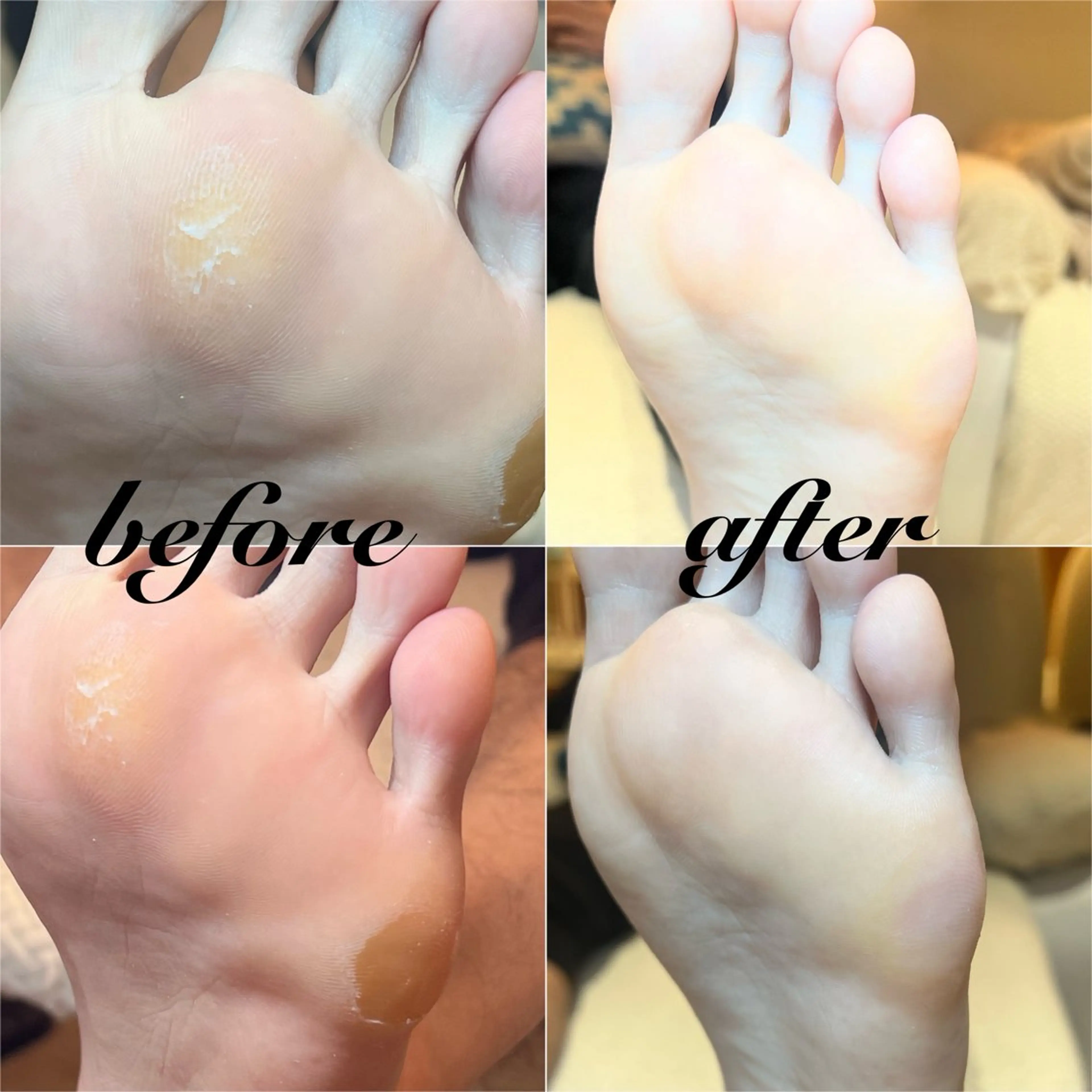 アロマバス&フットパック付き角質ケア🦶🏻✨の写真