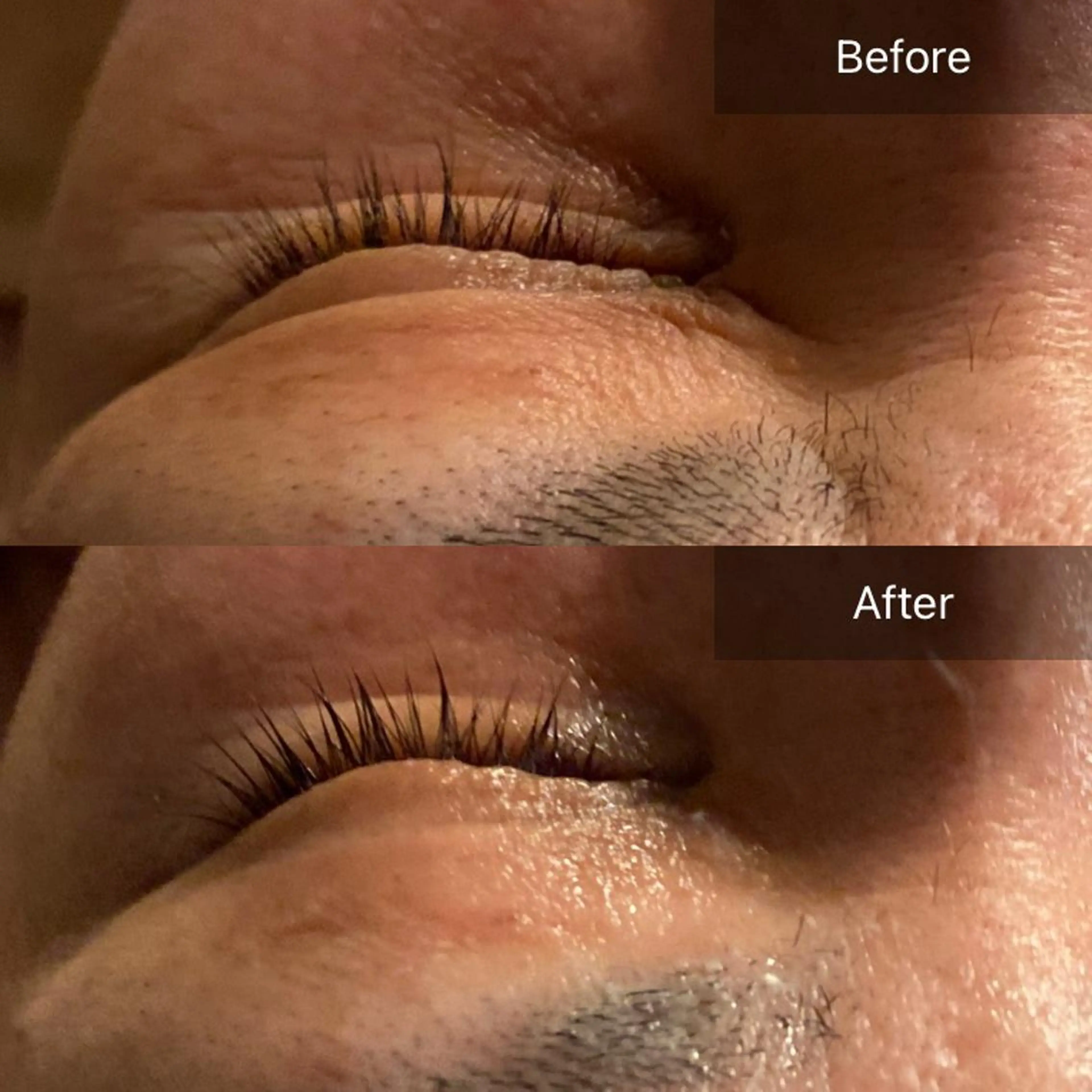 毛穴から始める肌メン テマンダリンオレンジのエステ・リラクイメージ