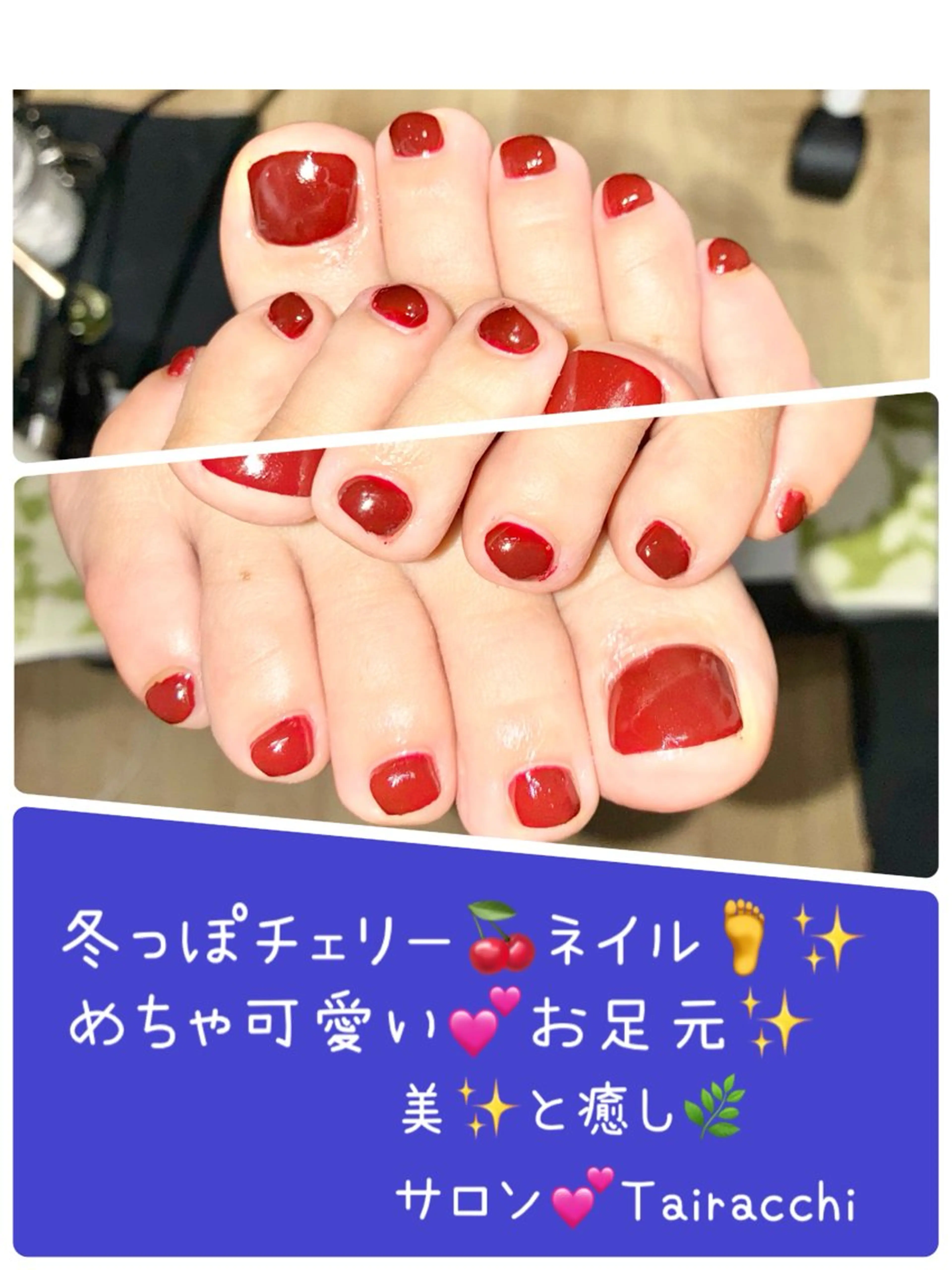 ネイル ボルドー フットネイル フットネイル Tairacchi タイラッチのエステ・リラクイメージ