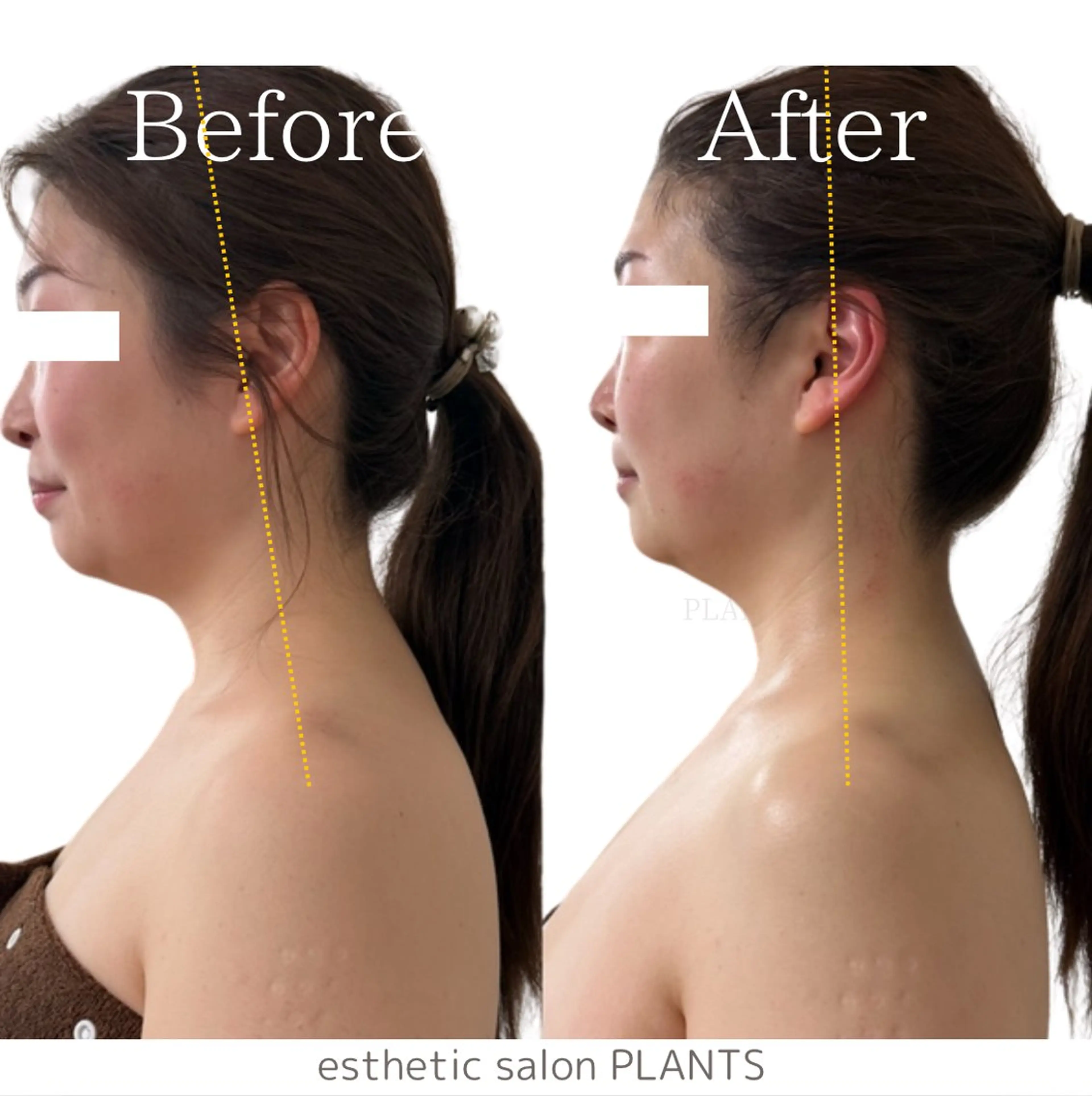 エステ esthetic salon PLANTS所属・エステティックサロン PLANTSのエステ・リラクイメージ