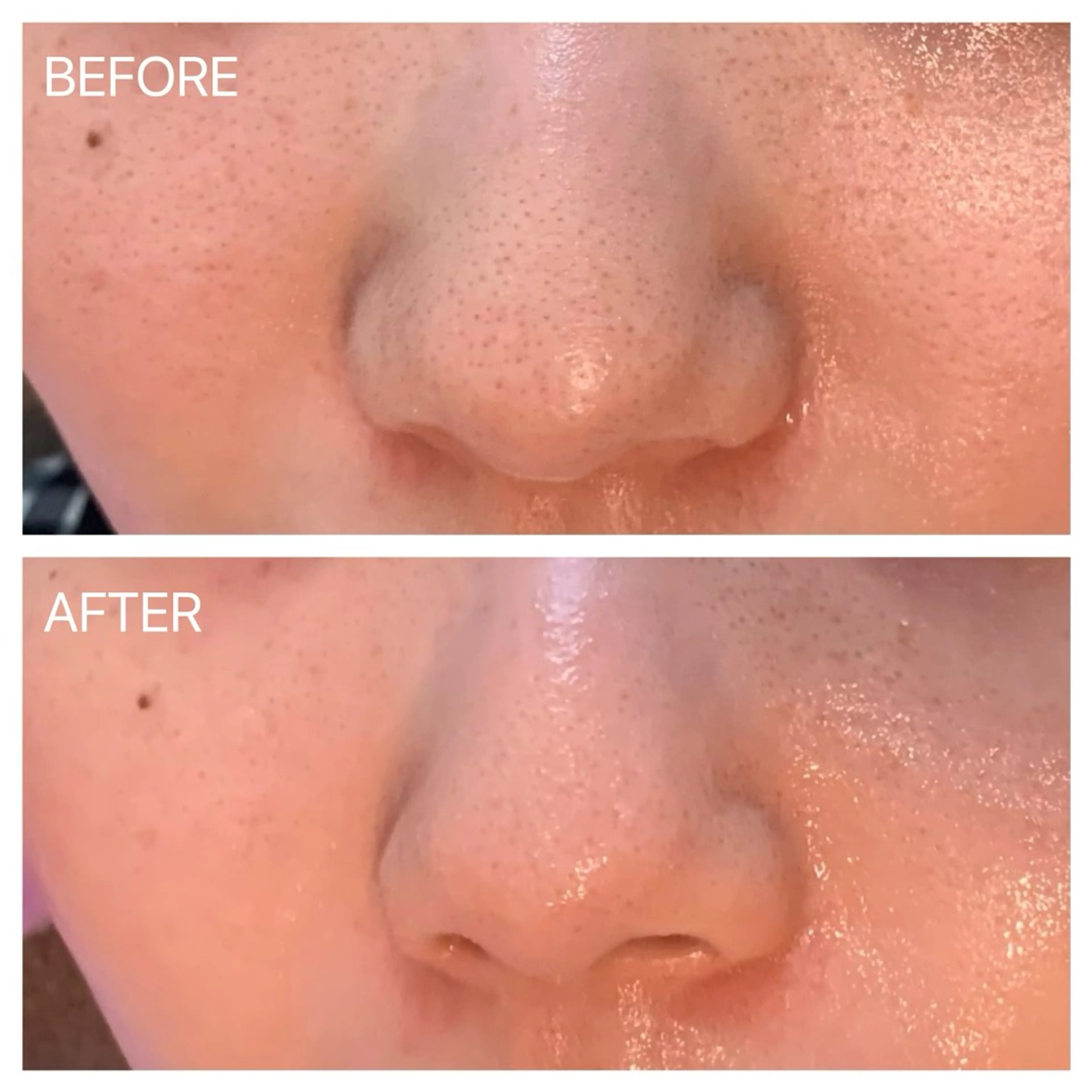 エステサロンSheep(美容室Sheep)所属・肌質改善専門 サロンのエステ・リラクイメージ