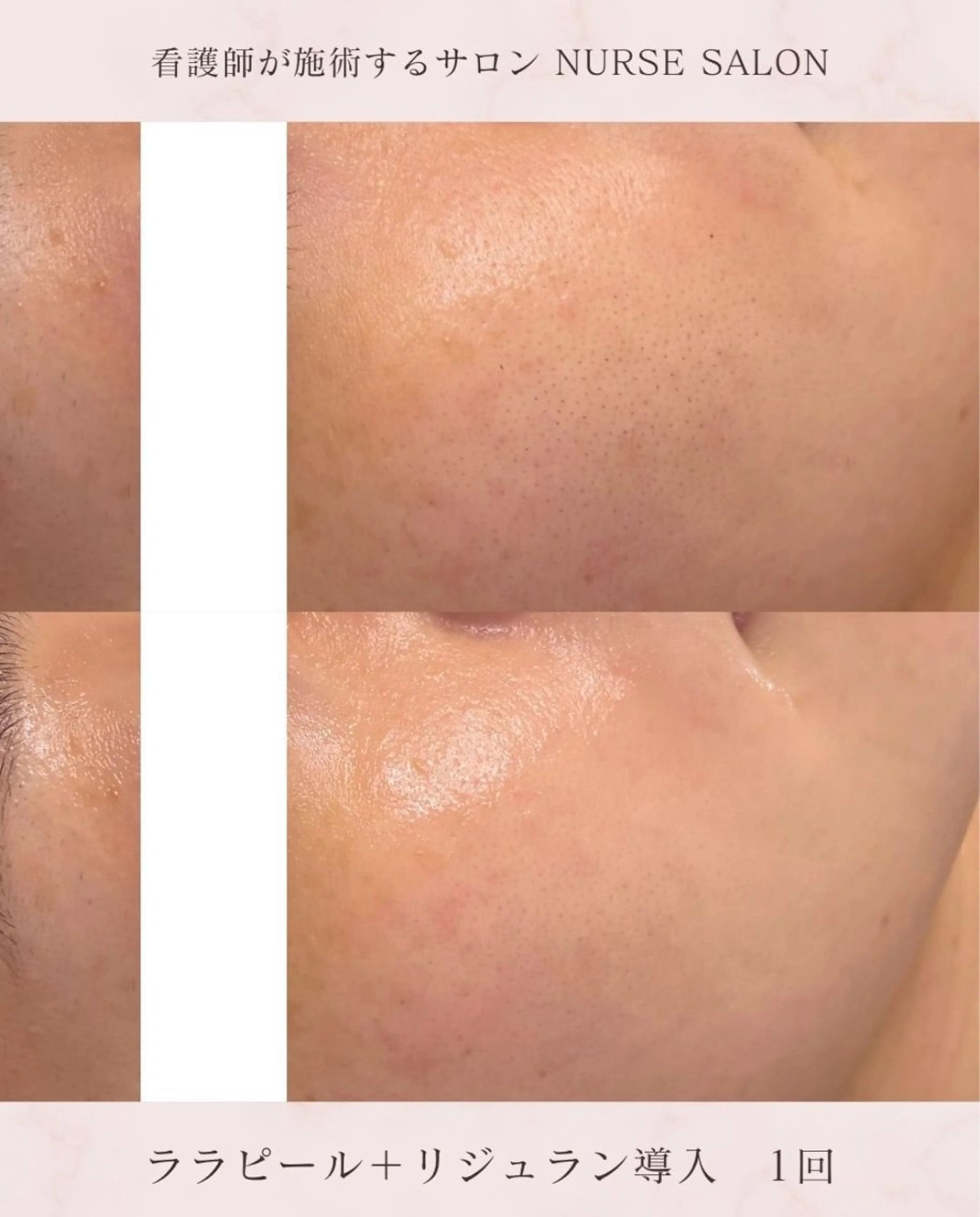 🌟看護師が施術🪄 ナスサロ/狩野のエステ・リラクイメージ