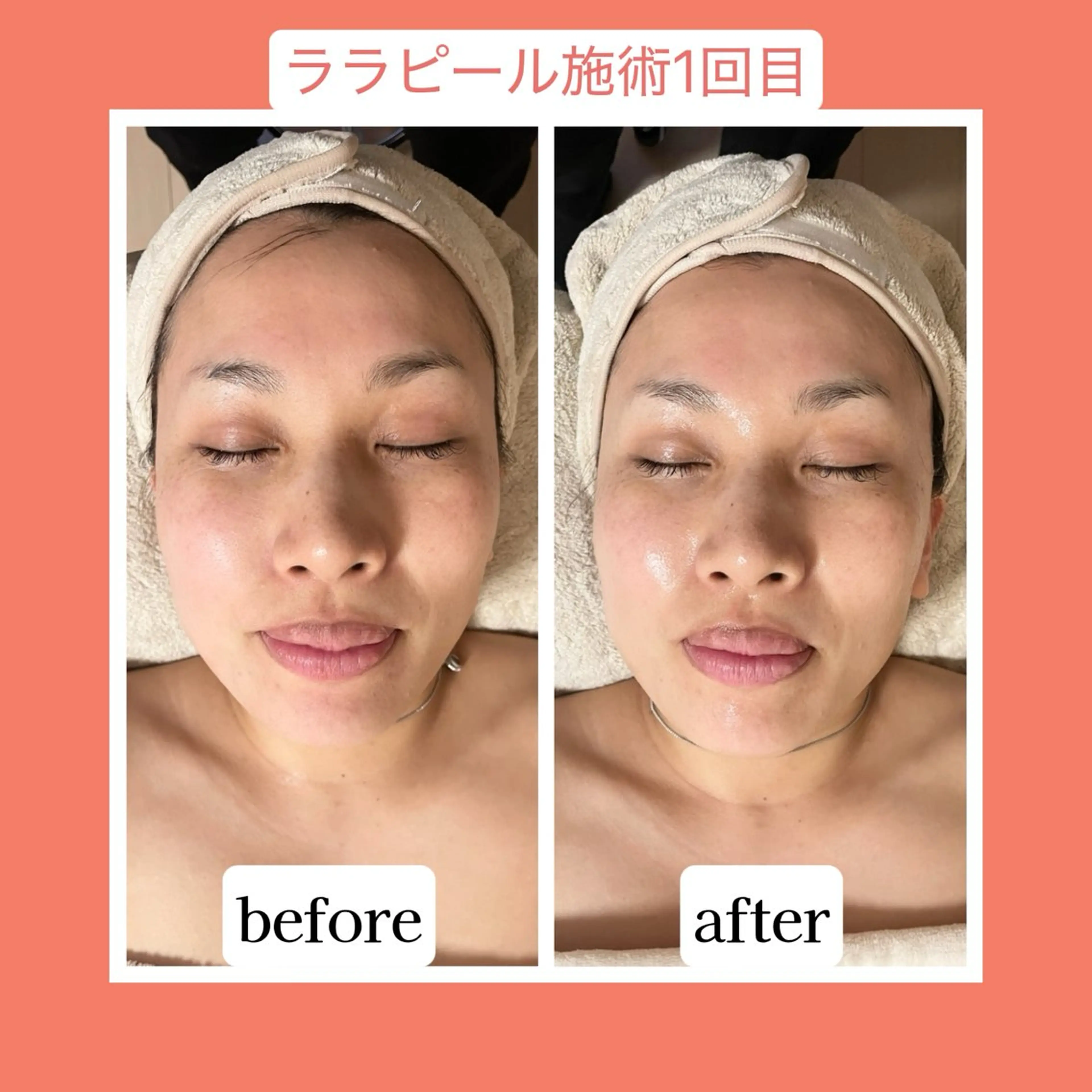 💜Karen PrivateSpaのエステ・リラクイメージ