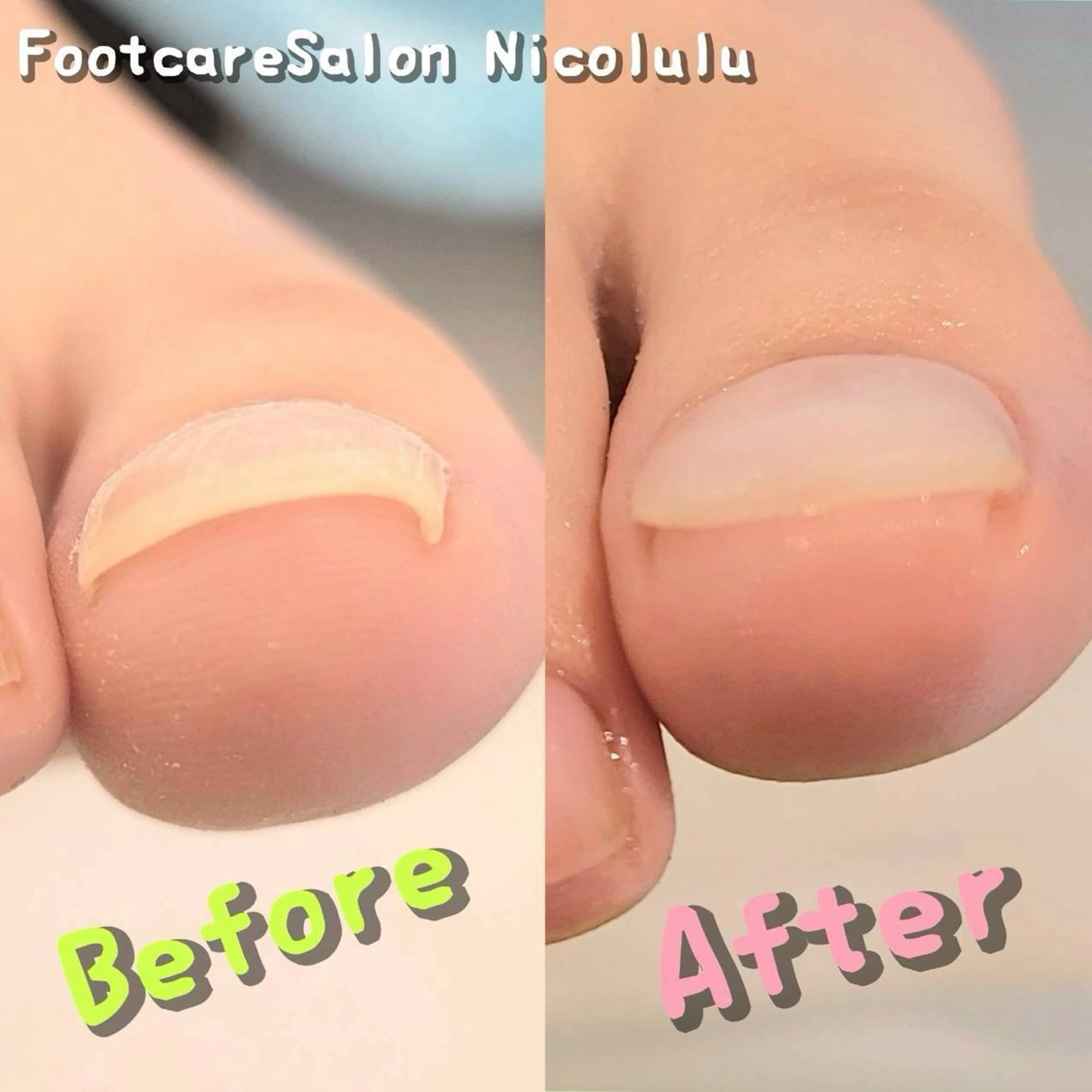 リラク 足トラブル専門 ニコルル金沢のエステ・リラクイメージ