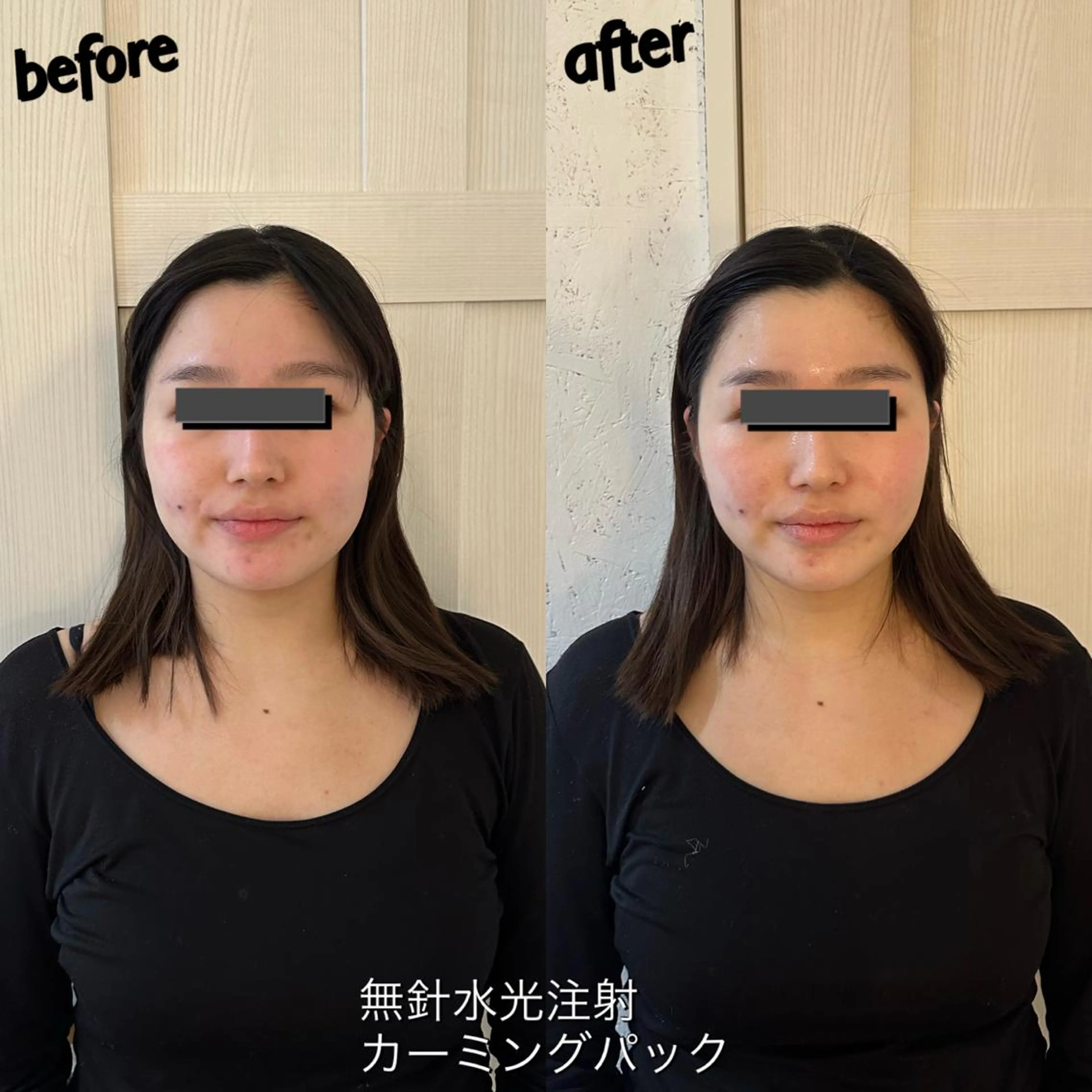 うなじ脱毛/美肌脱毛 LABELのエステ・リラクイメージ