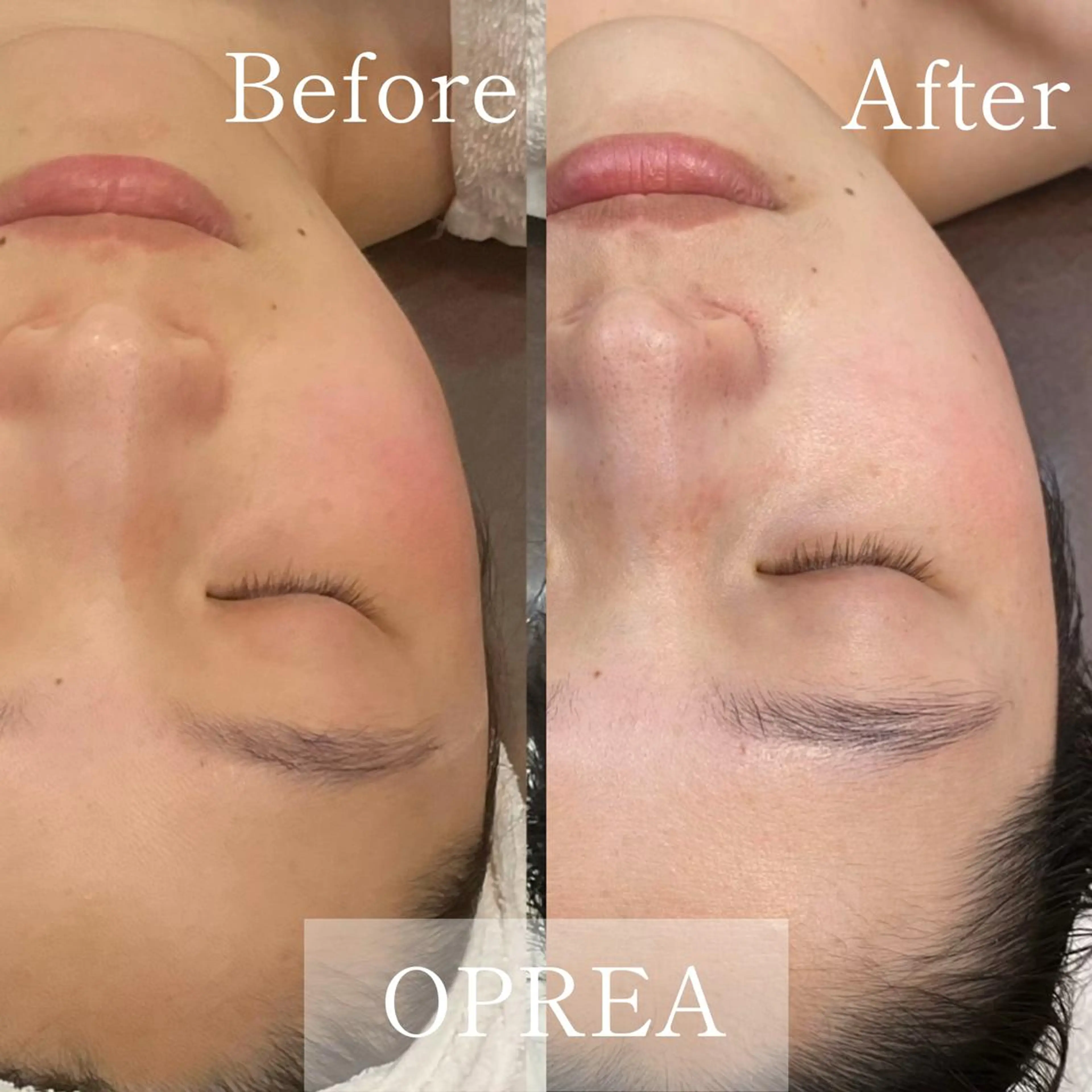 その他 OPREA 千種店のエステ・リラクイメージ