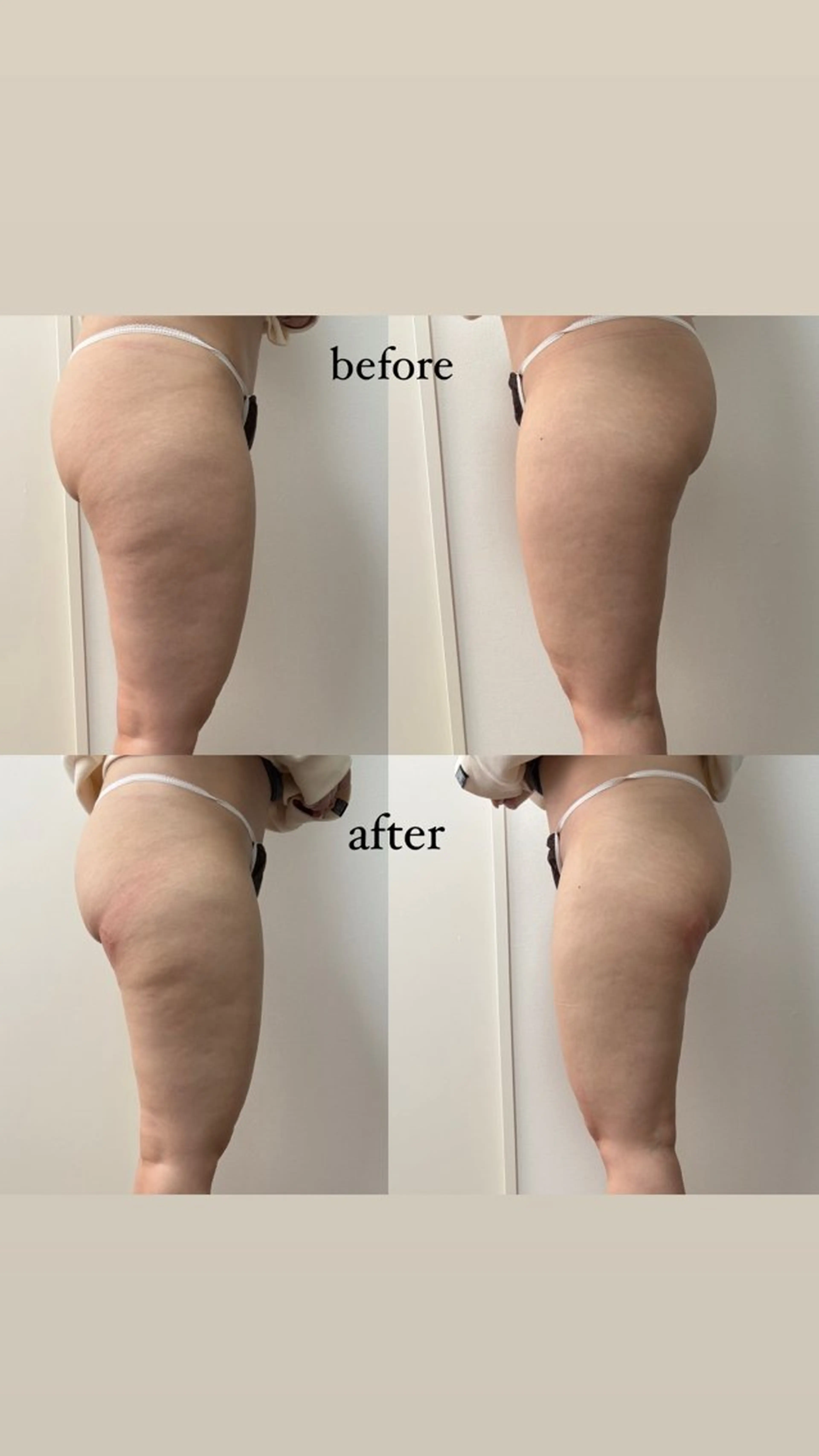 石巻 冷却痩身 Miiju. 鈴木のエステ・リラクイメージ