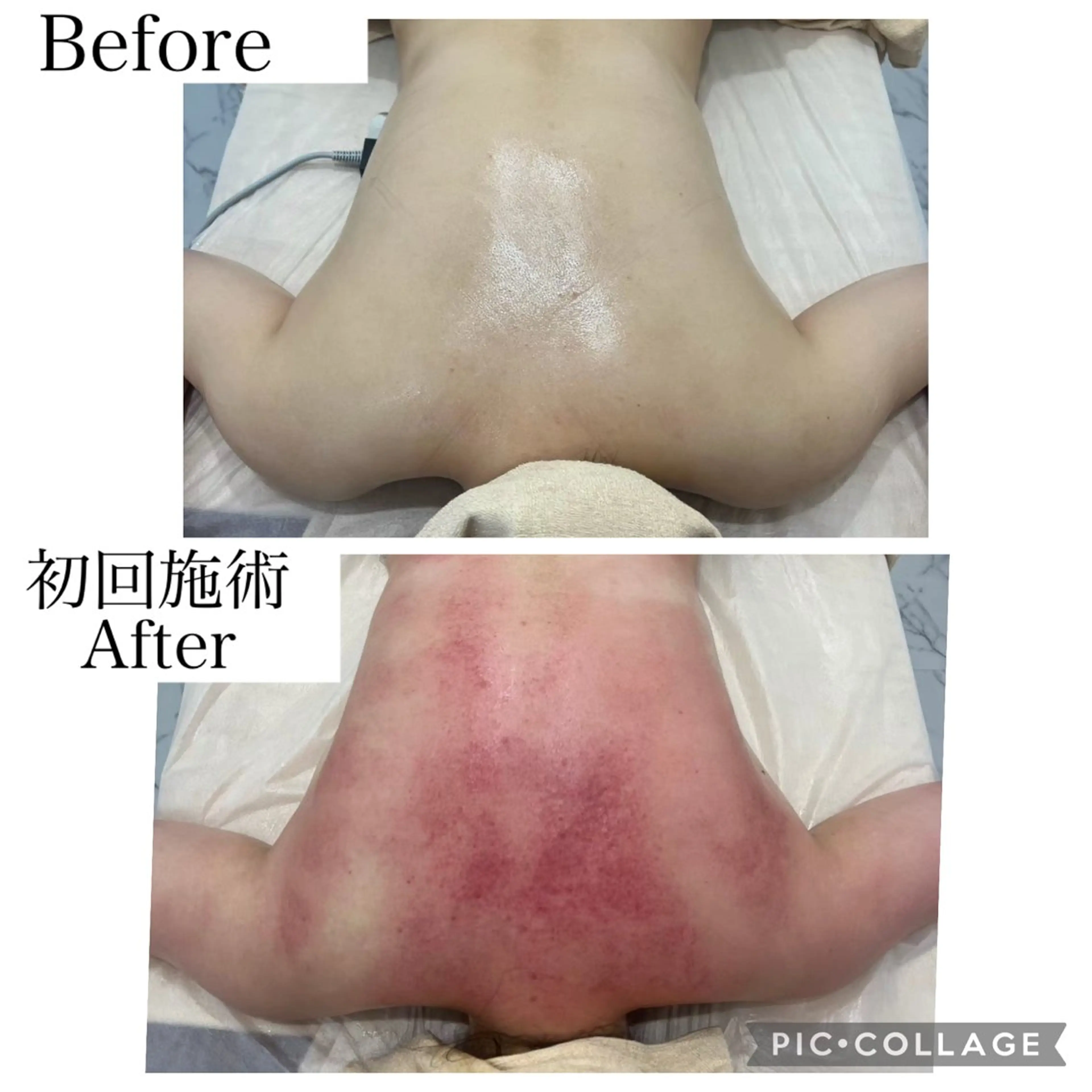 エステ ブライダル痩身×脱毛 尼崎駅前サロンのエステ・リラクイメージ