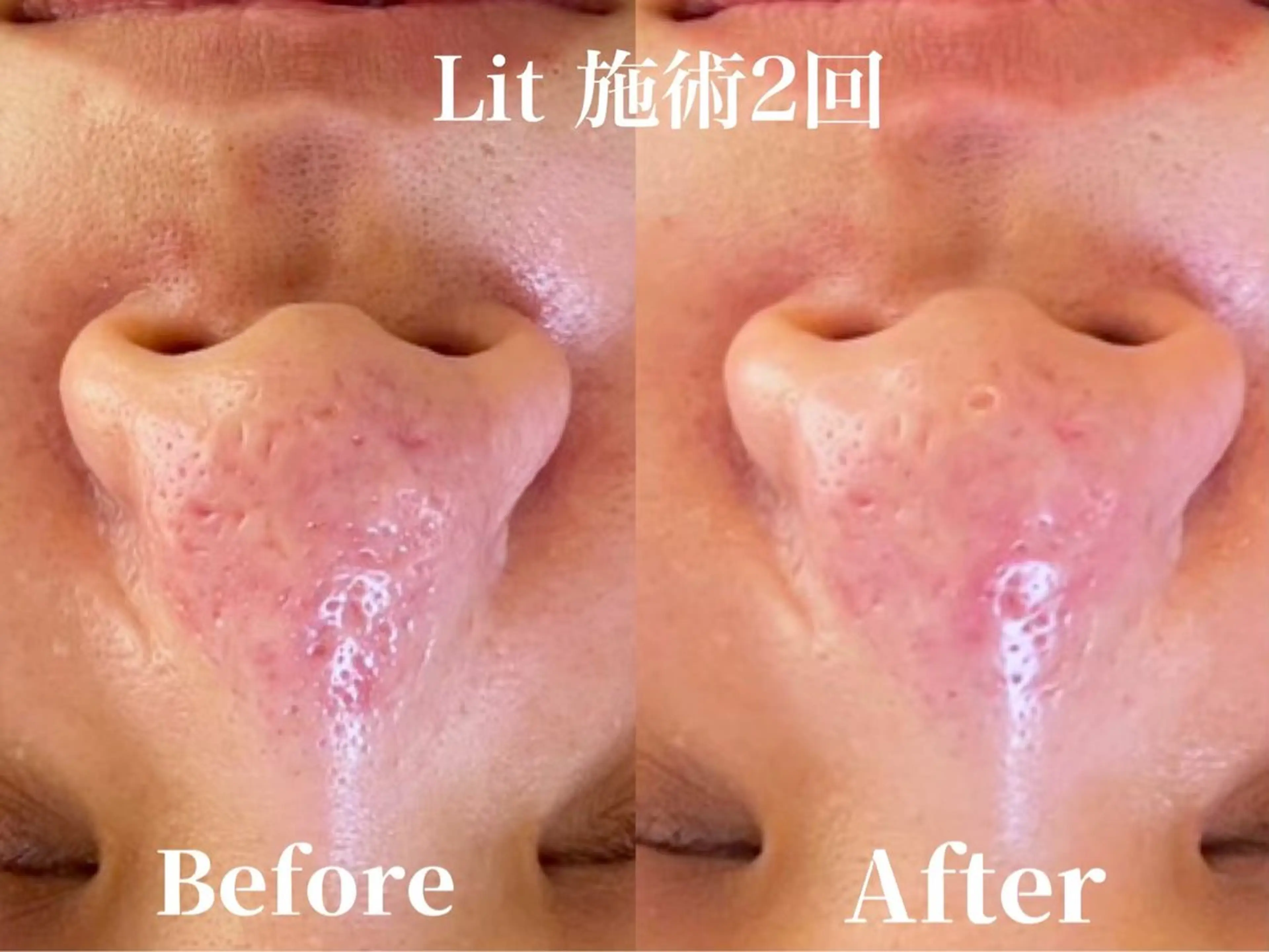 韓国肌管理HARRY ・ハリー🤍大村のエステ・リラクイメージ