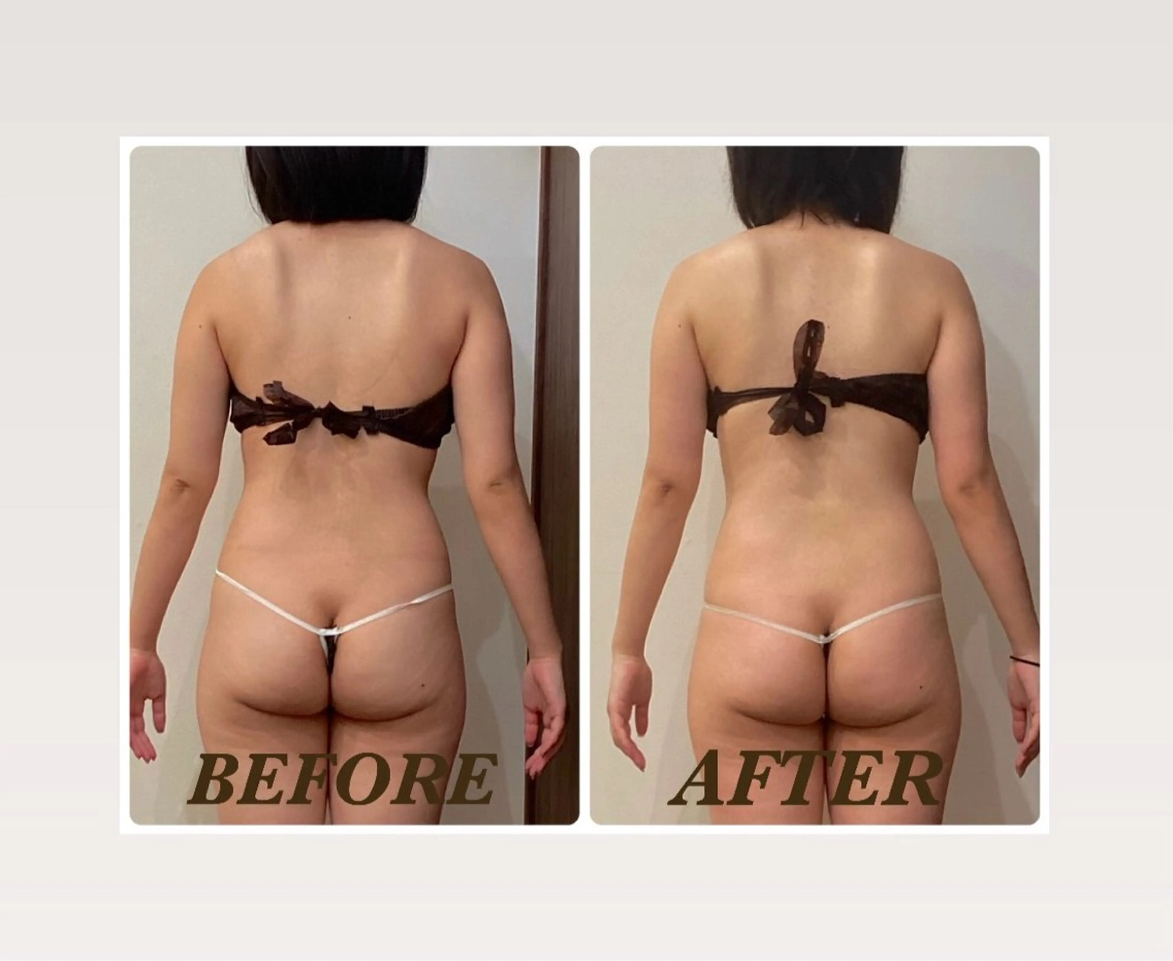 エステ リラク Prima 痩身脱毛 にごうかおりのエステ・リラクイメージ