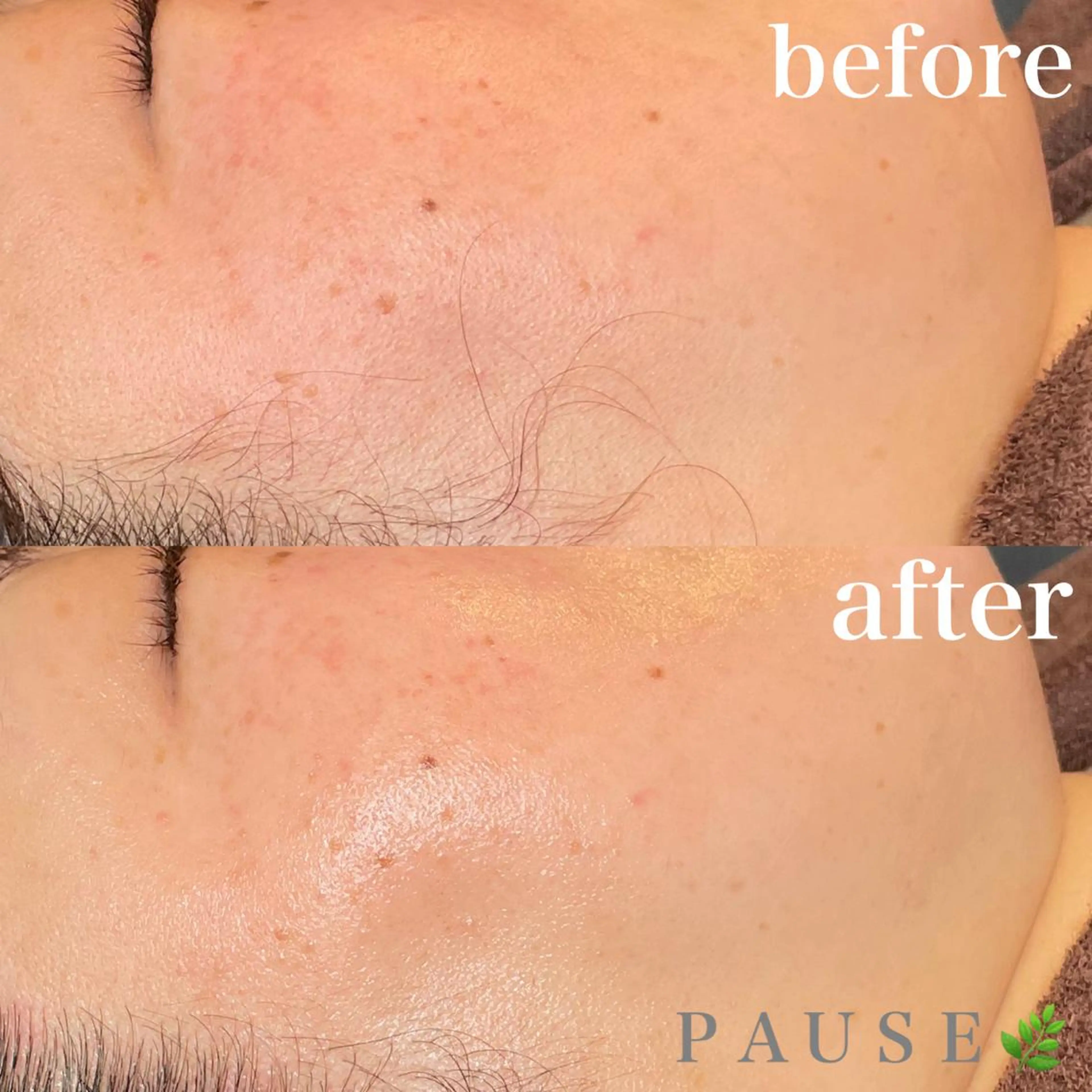 エステ 浜野 恵美のエステ・リラクイメージ