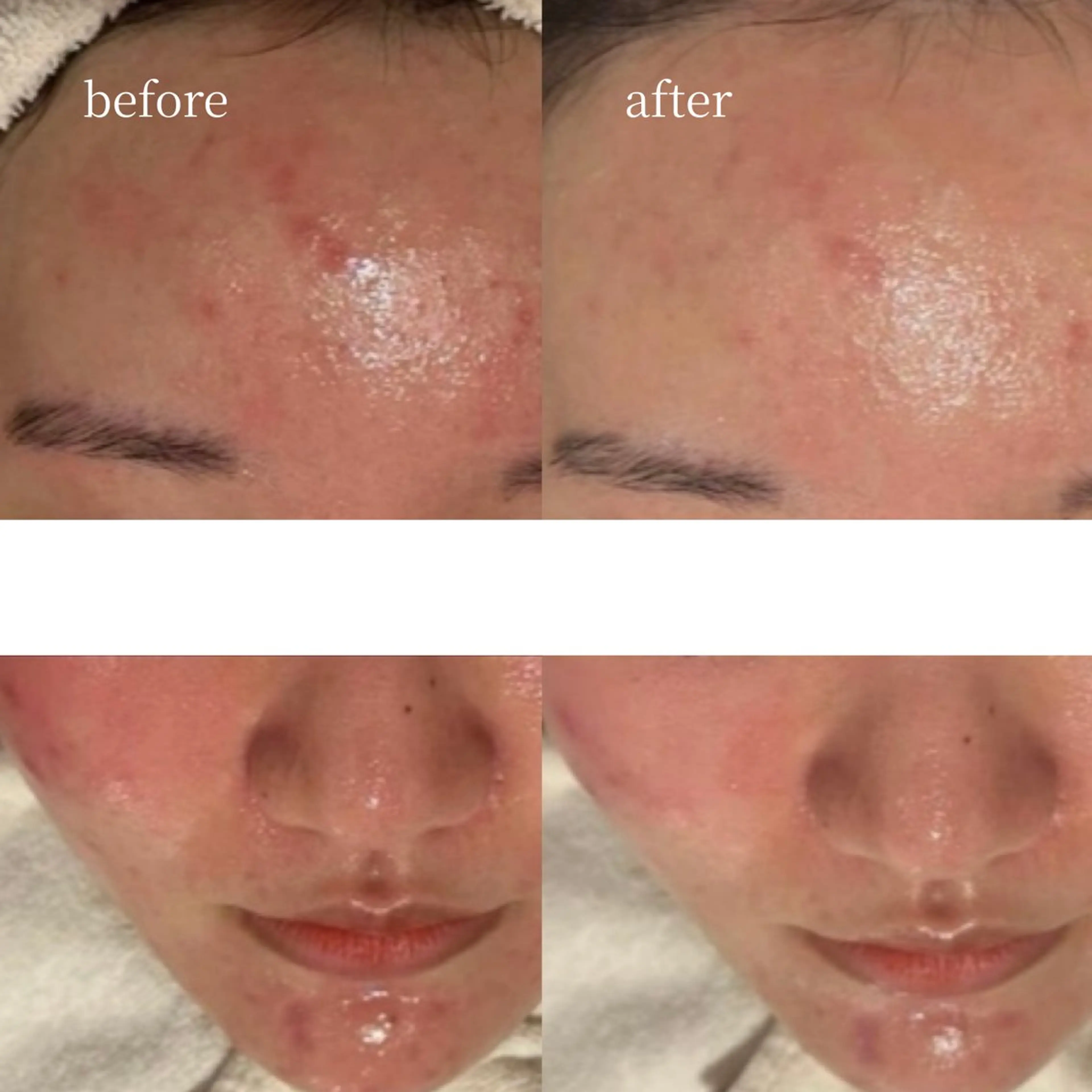 韓国肌管理・肌質改善 EARNEST心斎橋のエステ・リラクイメージ