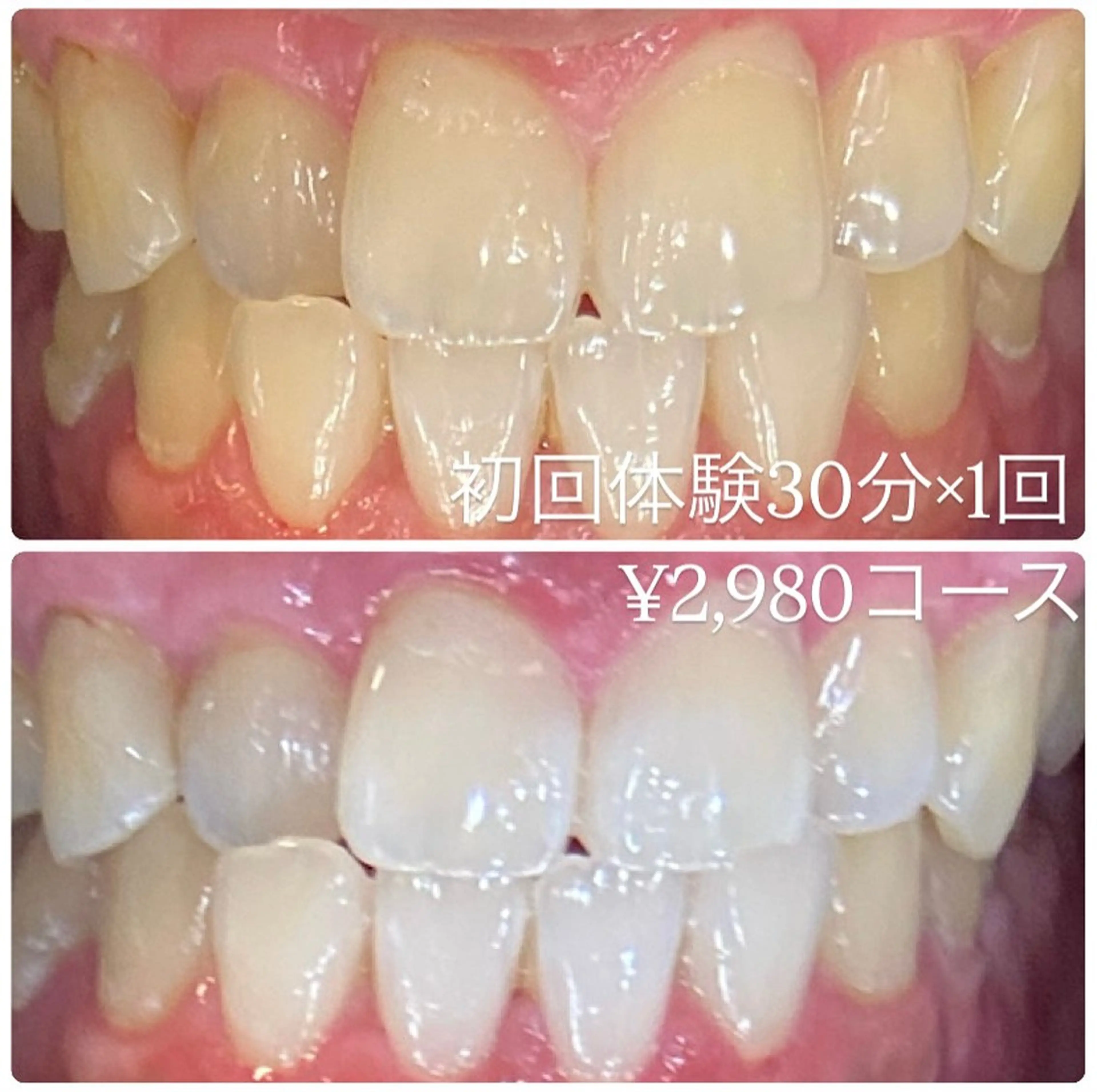 ホワイトニングルーム 横浜店のその他イメージ