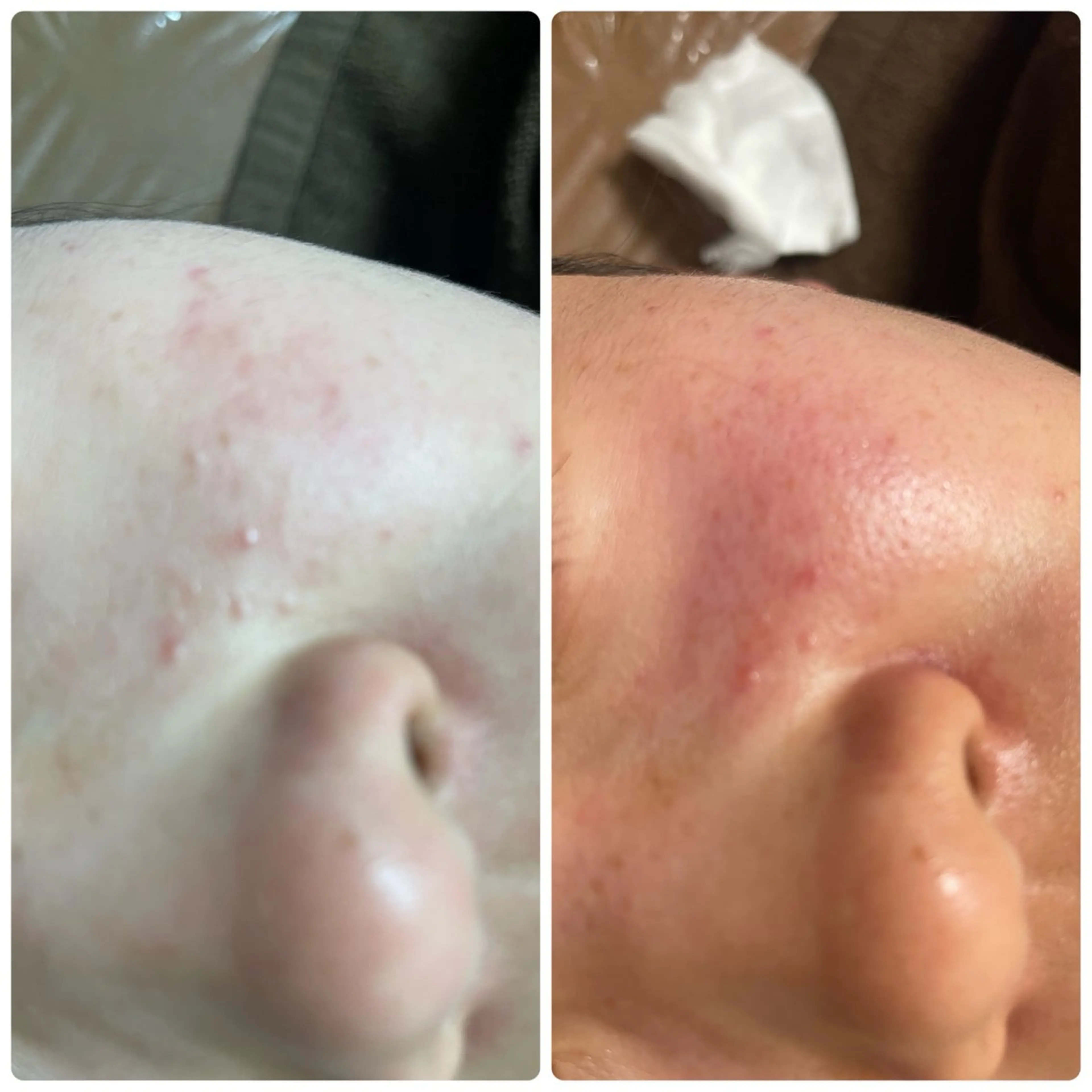 🔰 新米ネイリストのネイルデザイン