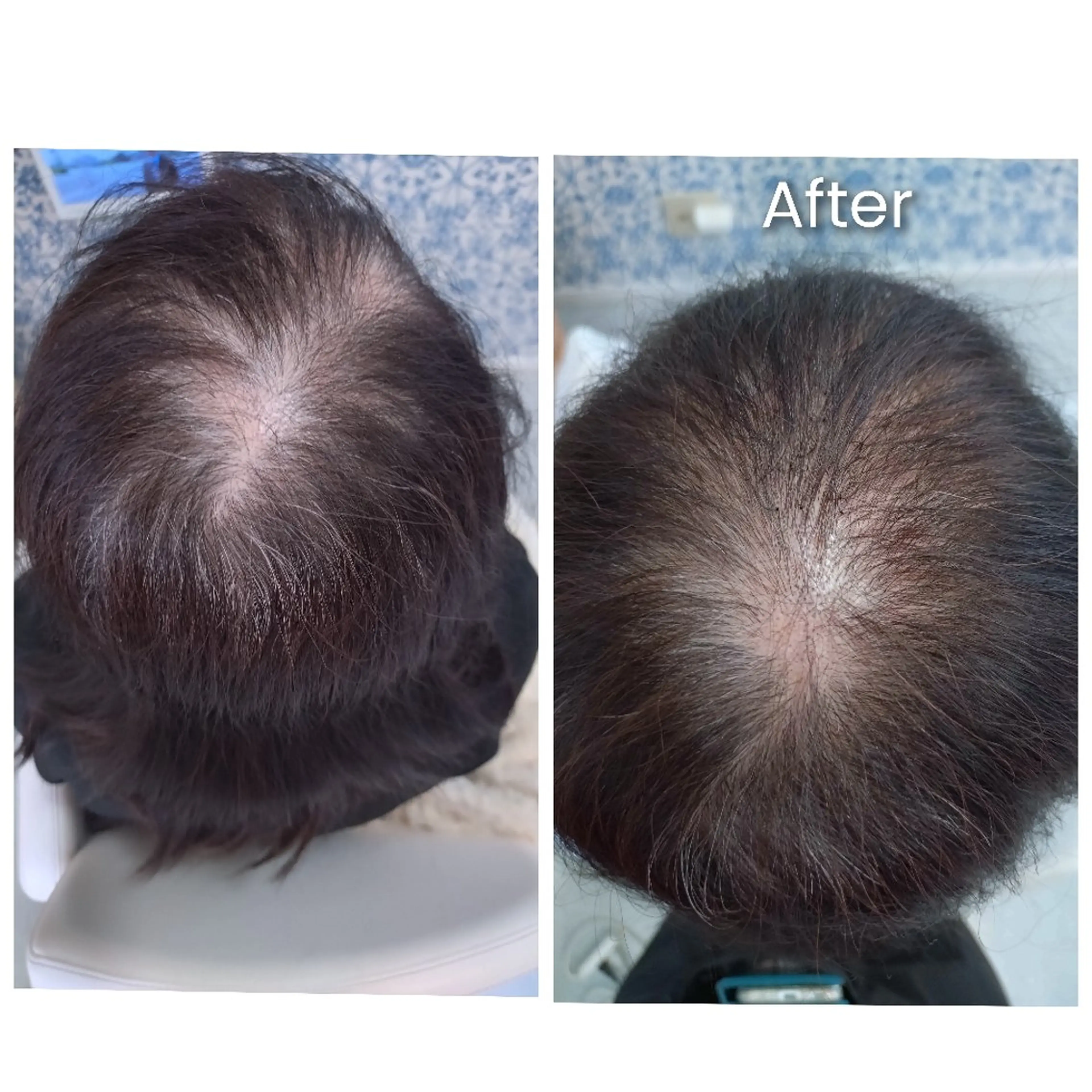 ショート エクステ 【トータル美容】 Eternityのその他イメージ