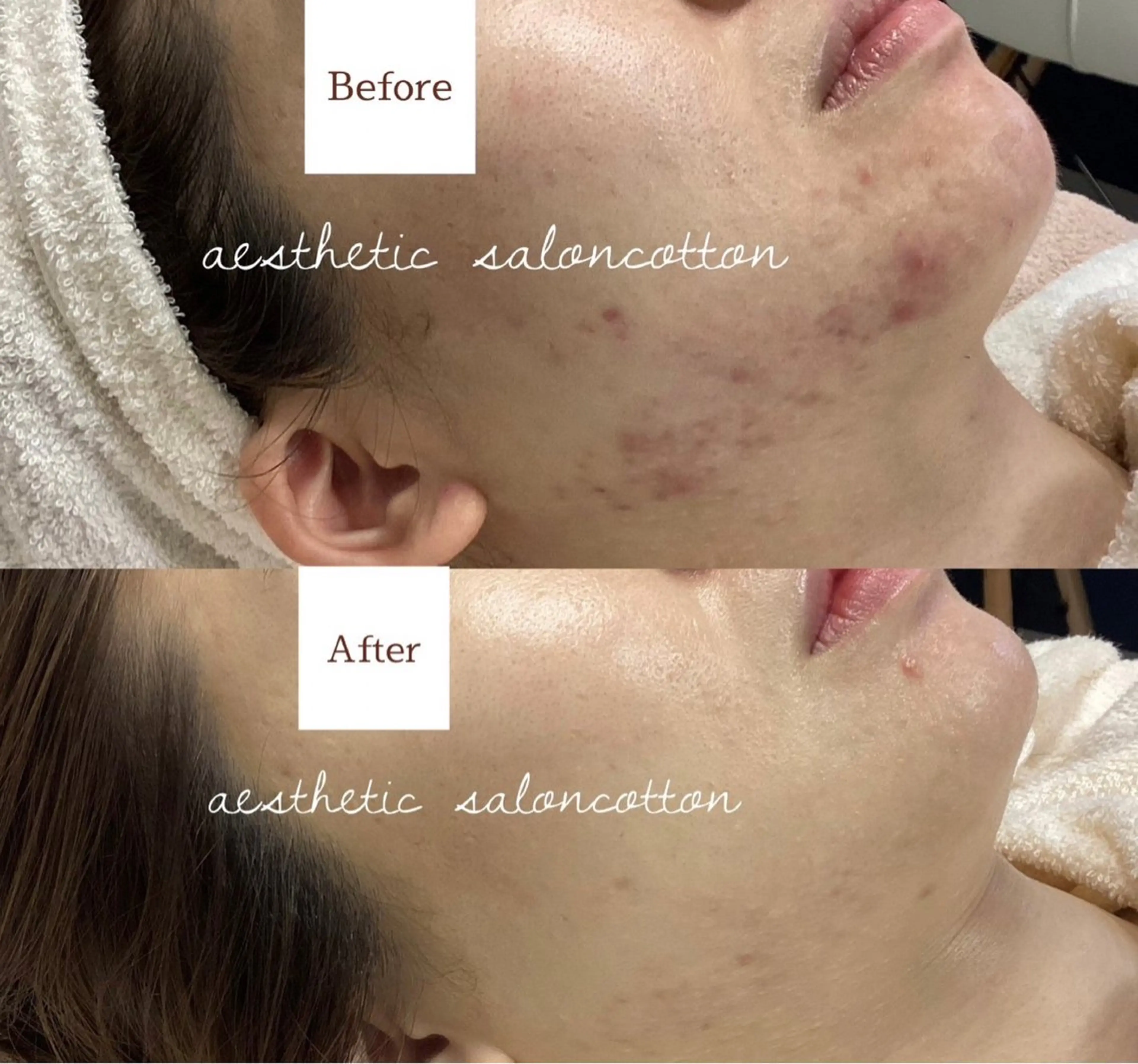 エステ 都度払い 肌質改善専門サロンのエステ・リラクイメージ