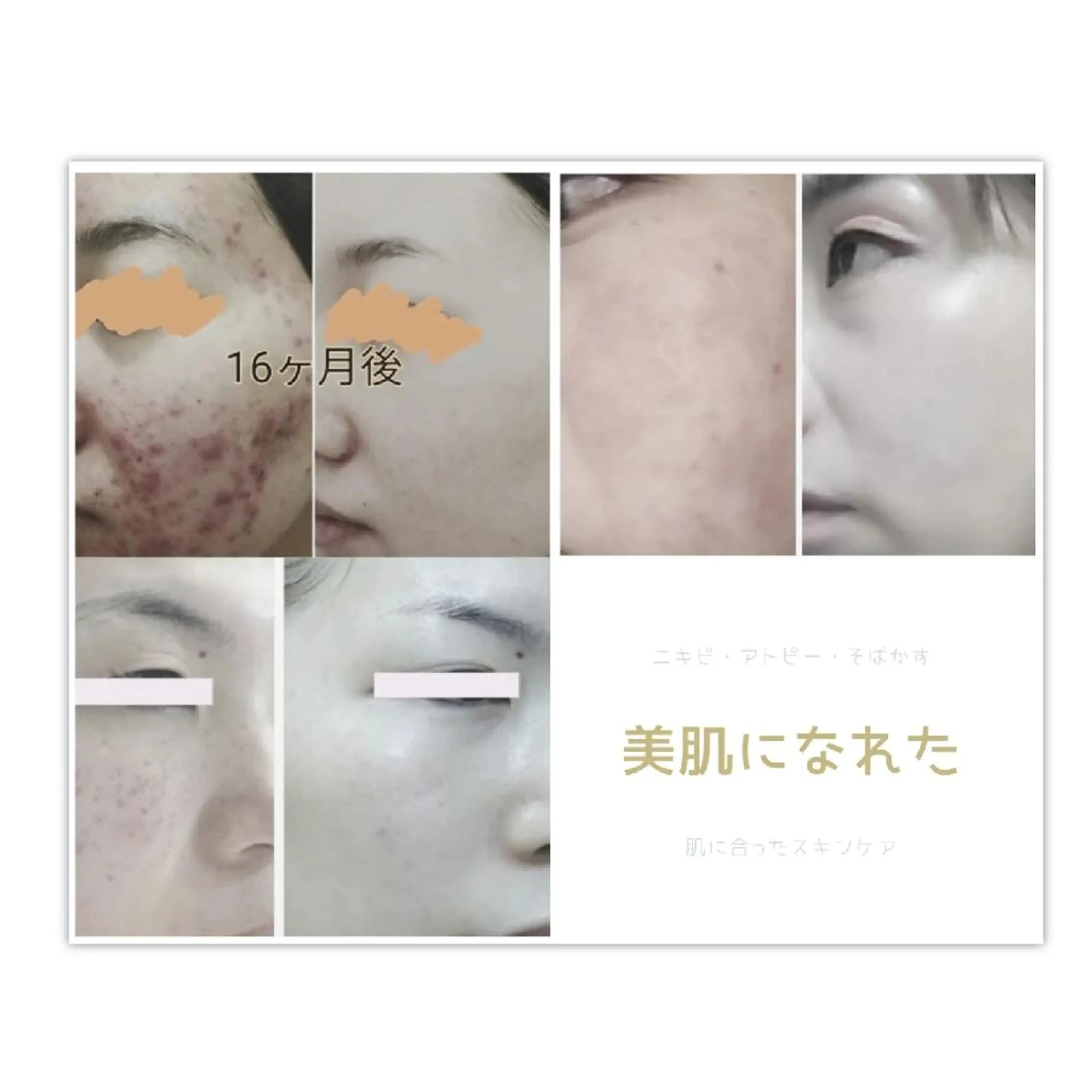 メディカルサロン  風露のエステ・リラクイメージ