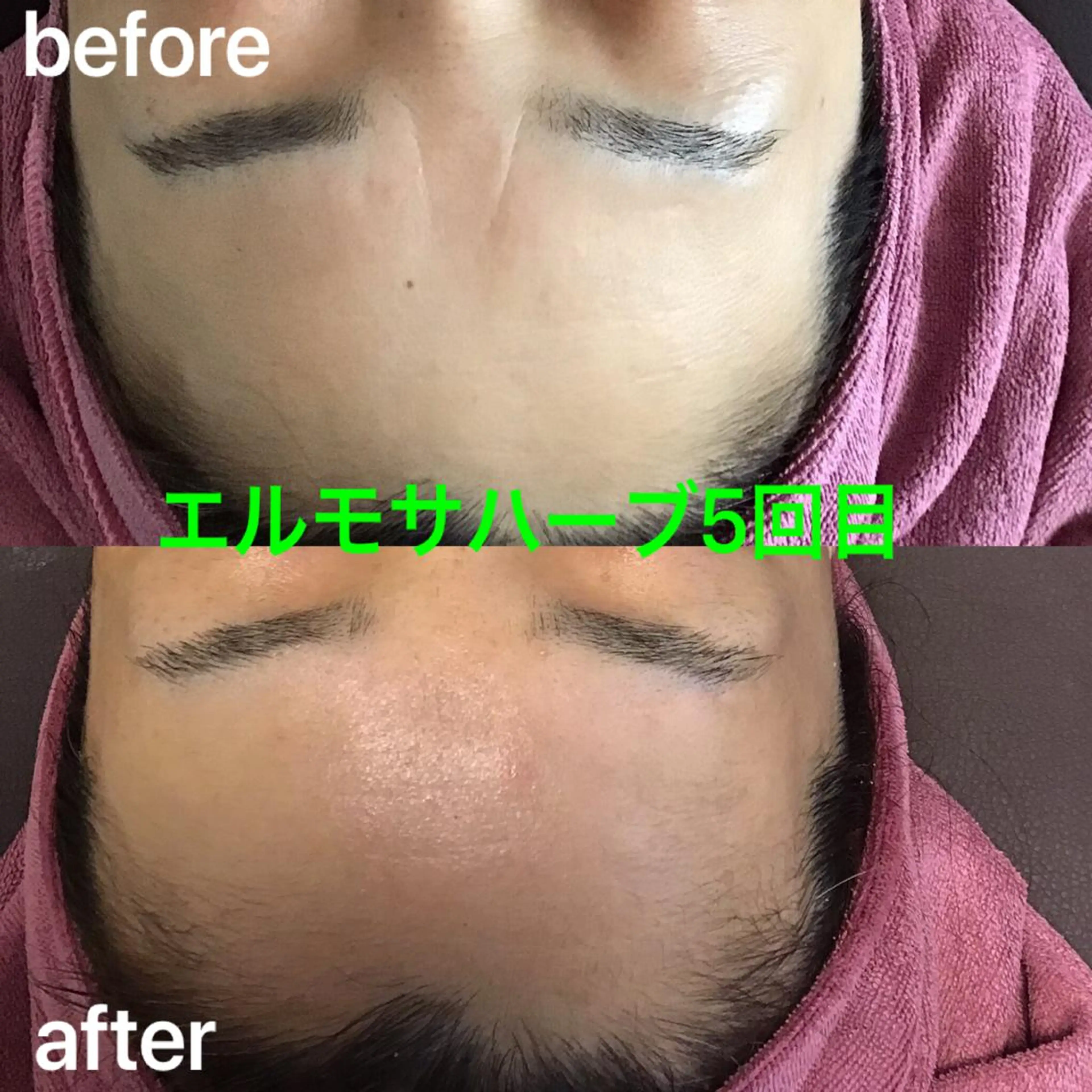 エステ 氣楽所属・松下 さゆりのエステ・リラクイメージ