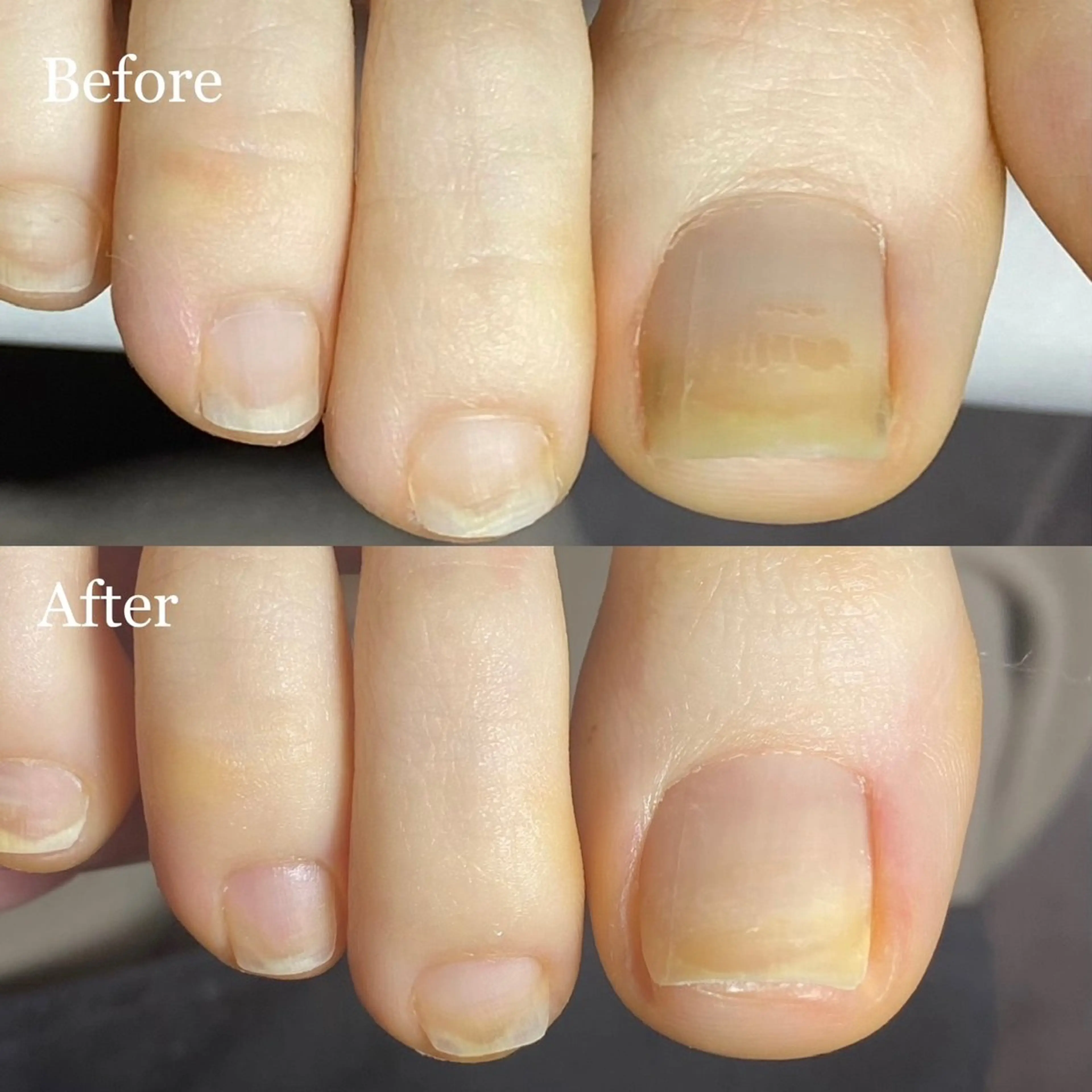 ネイル 長さ出し フットネイル ジェルネイル NailTailor ネイルテイラーのネイルデザイン