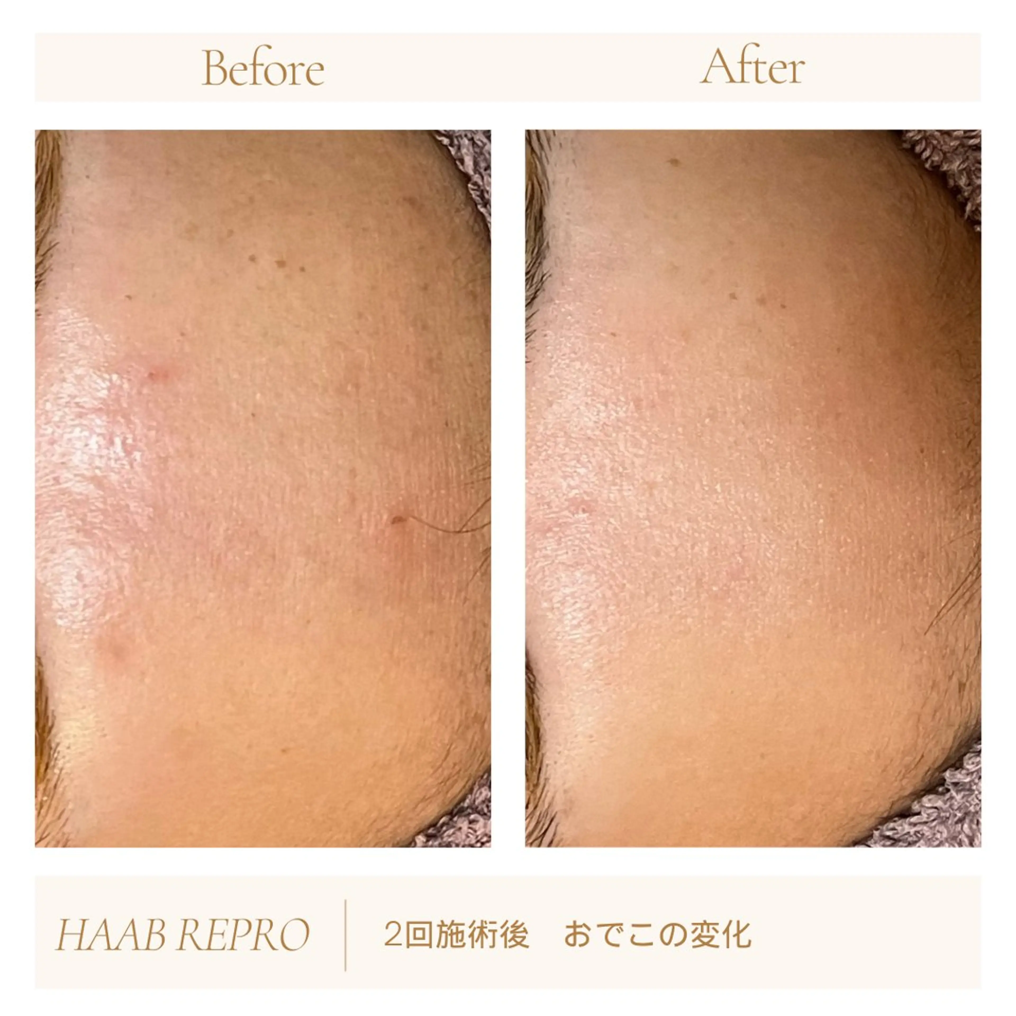 1ヶ月後も半分残る 高持続LEDエクステのマツエク・マツパデザイン