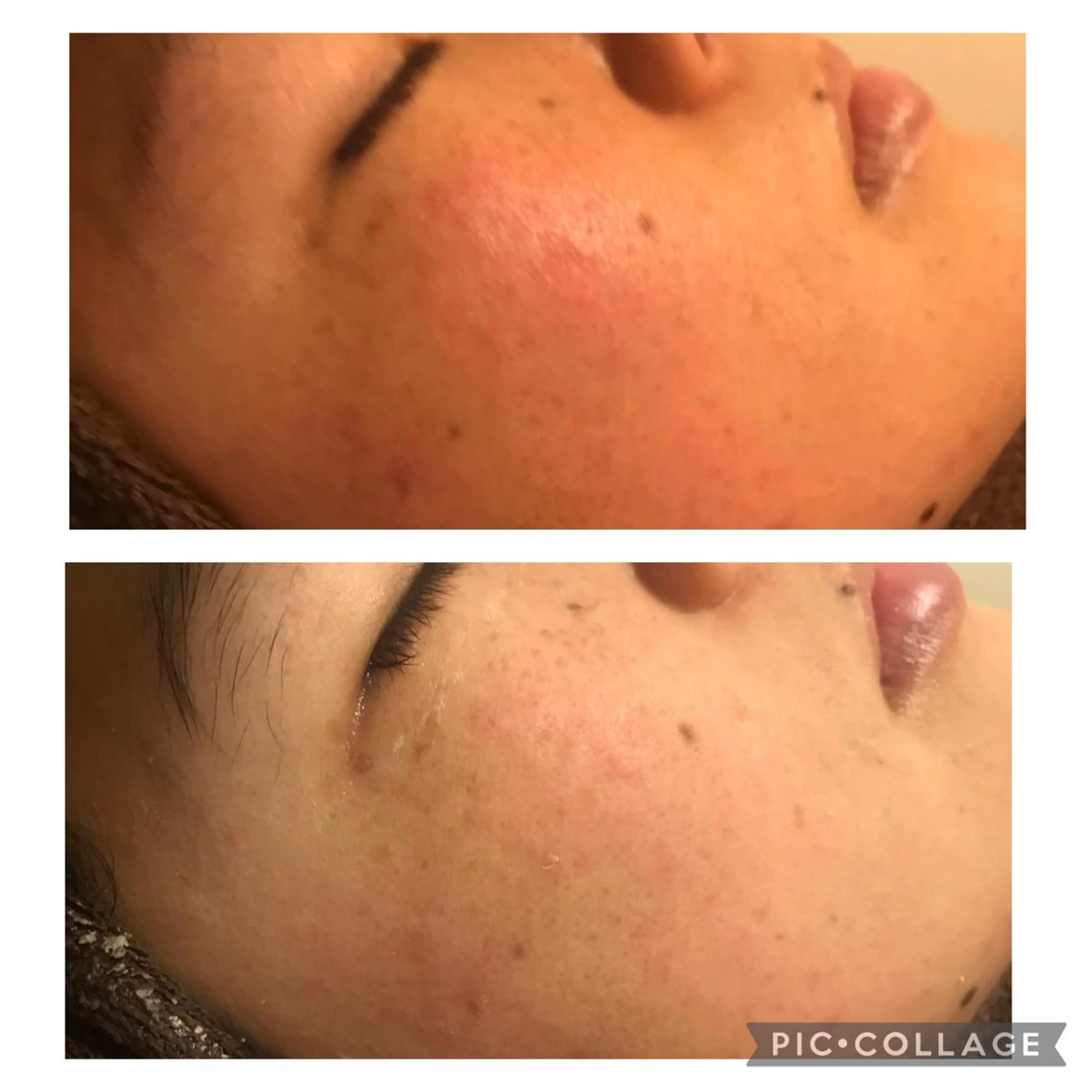 ミディアム カラー パーマ ヘアアレンジ メンズ キッズ ネイル マツエク・マツパ アニメ,Vオタク× 即効痩せエステサロンのエステ・リラクイメージ