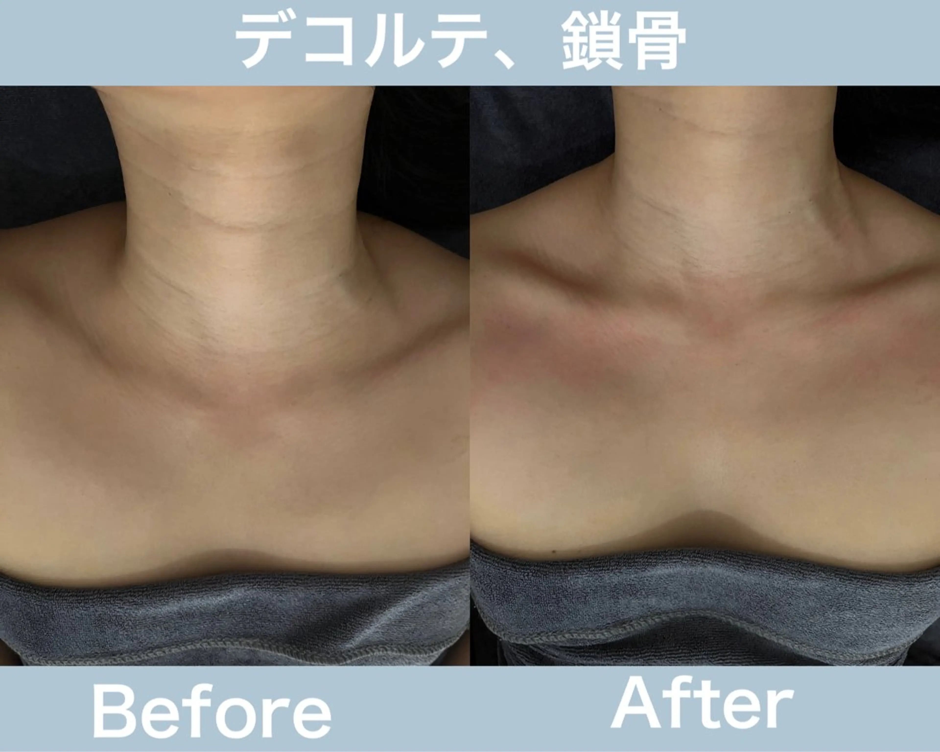 タイ古式マッサージ 白金台 目黒のエステ・リラクイメージ