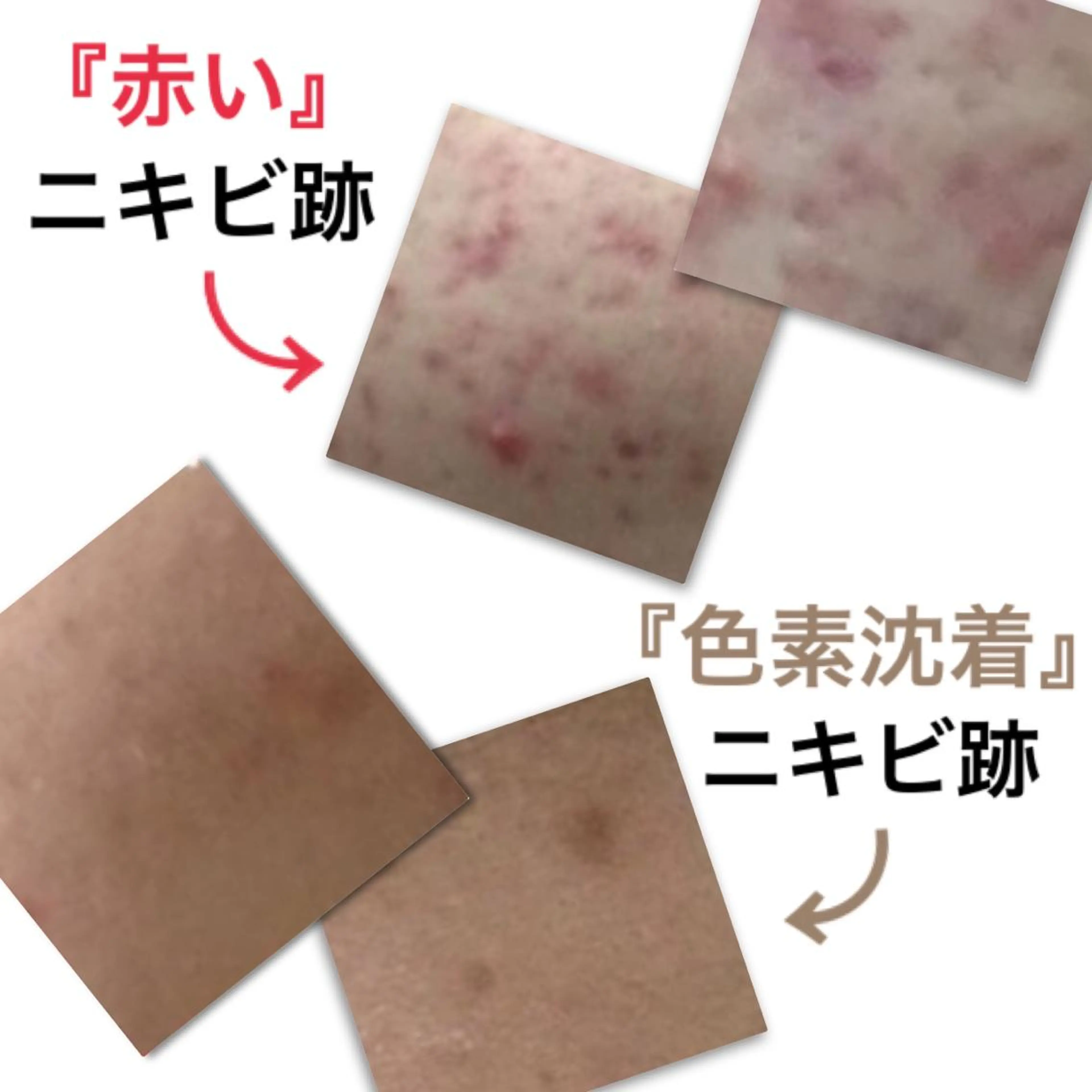 ロング カラー パーマ ヘアアレンジ キッズ ネイル マツエク・マツパ 都度払い肌質改善 &脱毛Blancheのエステ・リラクイメージ