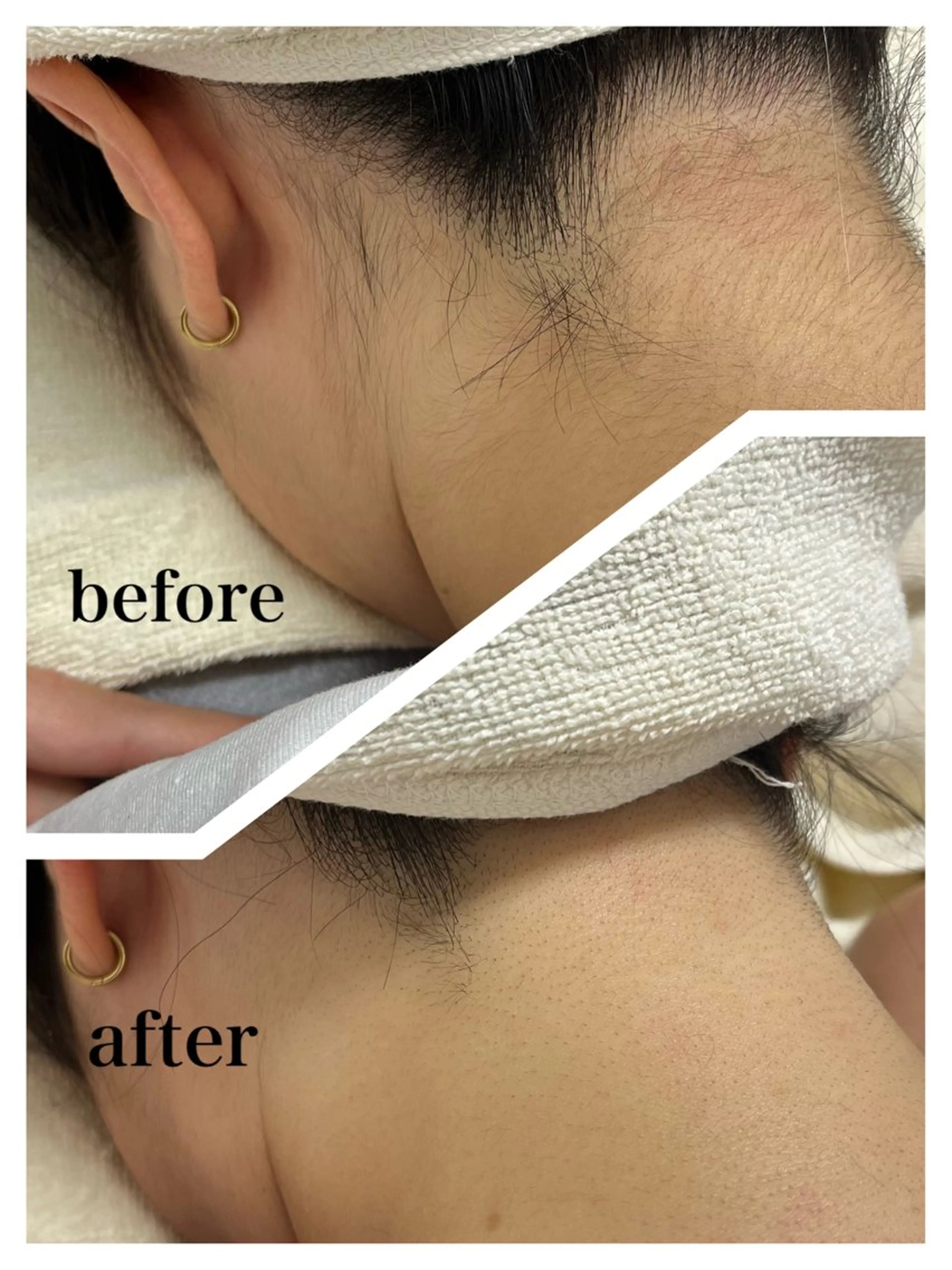 脱毛 プライベートサロン Linoのエステ・リラクイメージ