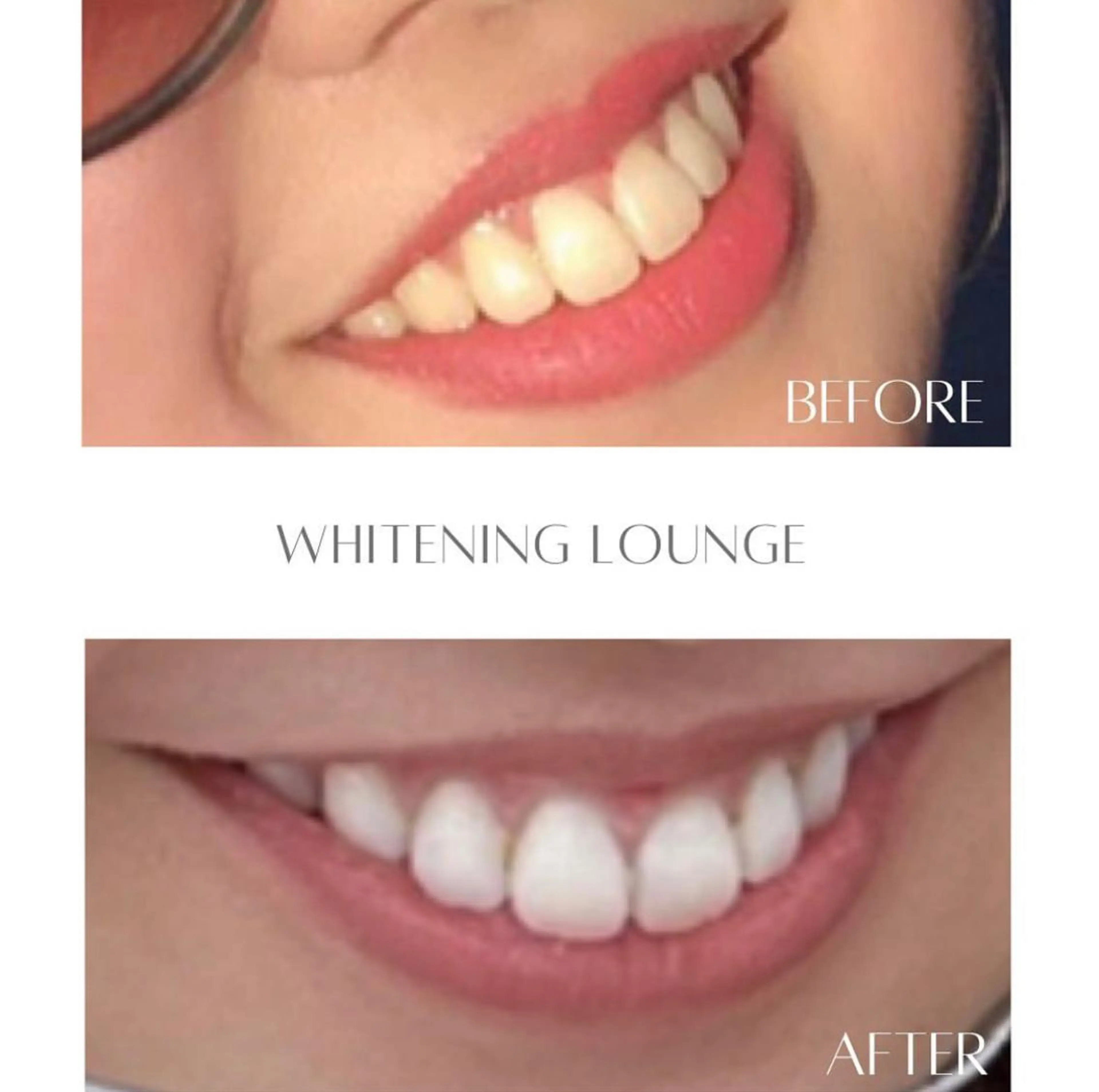 ホワイトニング Lounge横須賀のエステ・リラクイメージ