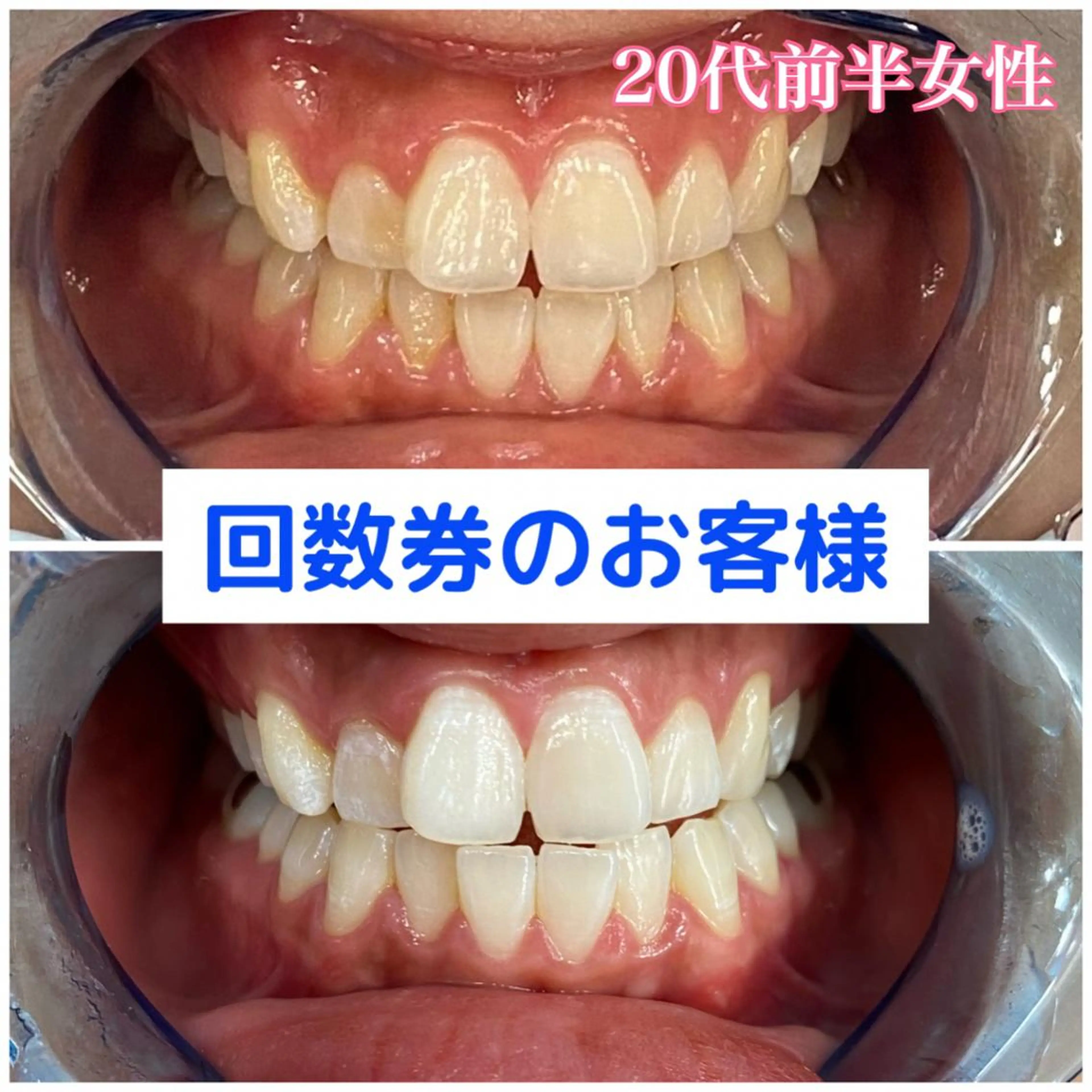 Platinum Beauty 四条烏丸店所属・吉田亮利 ホワイトニング専門店のその他イメージ