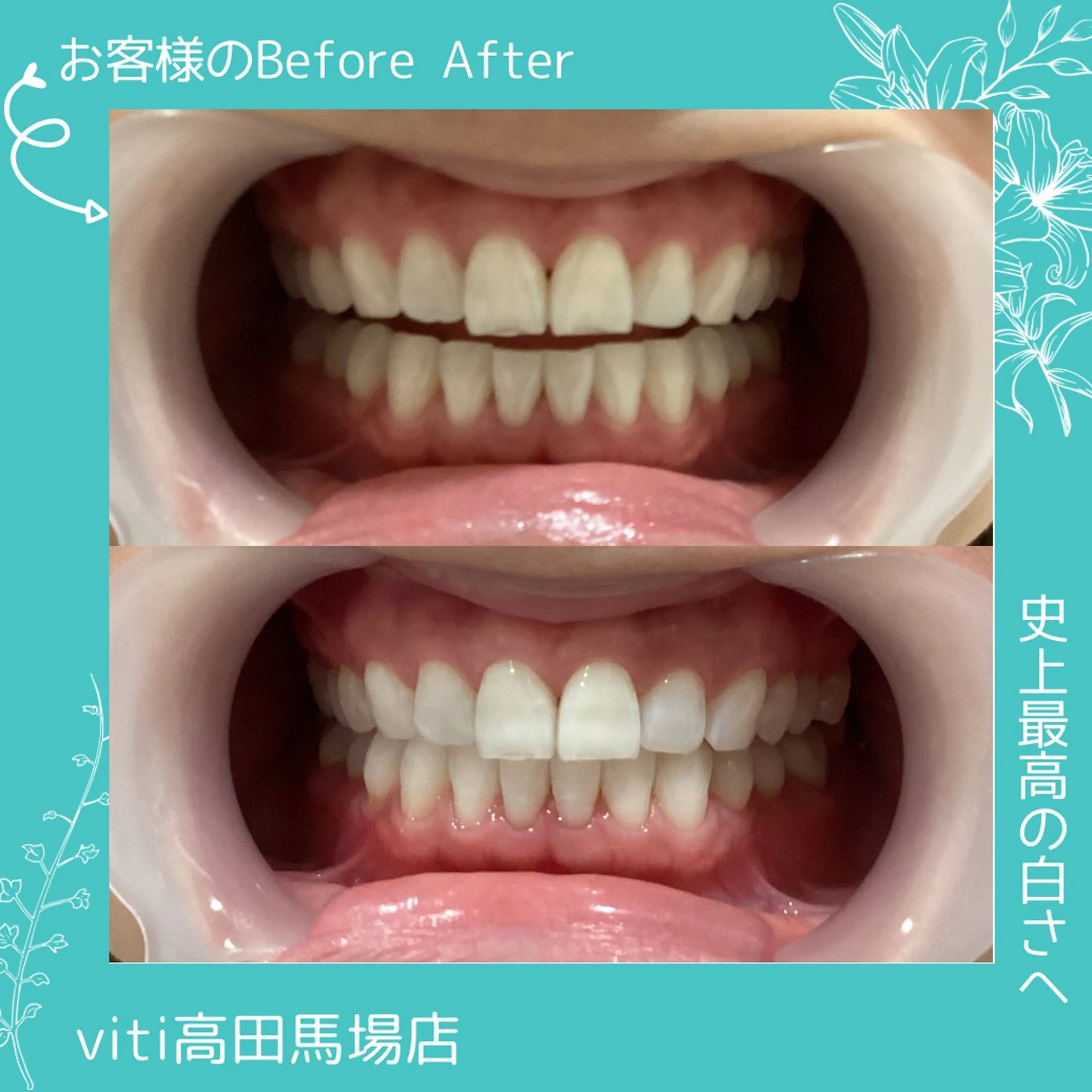 その他 viti 高田馬場店のその他イメージ