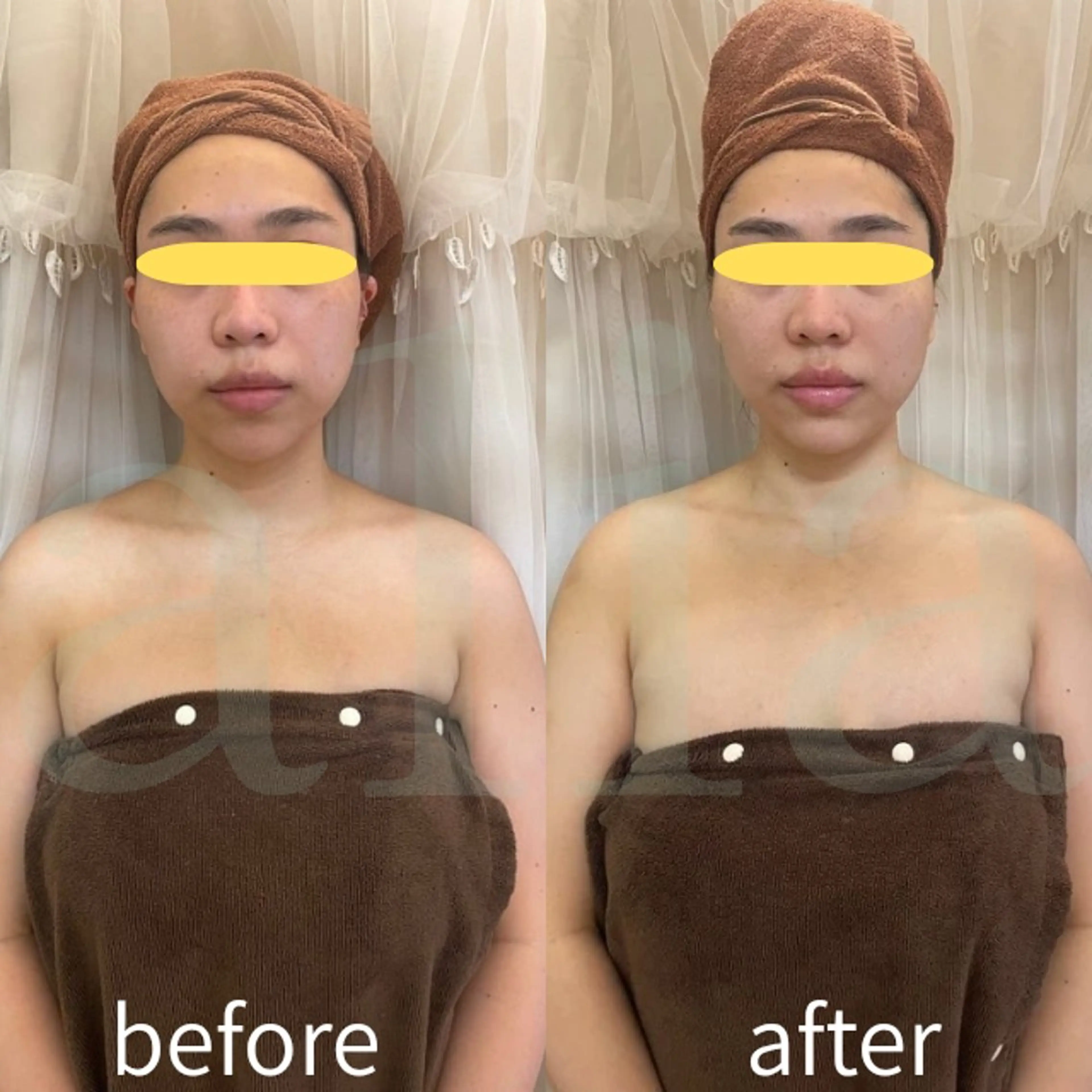 エステ リラク aliaハーブ水光店 エステティシャン募集のエステ・リラクイメージ