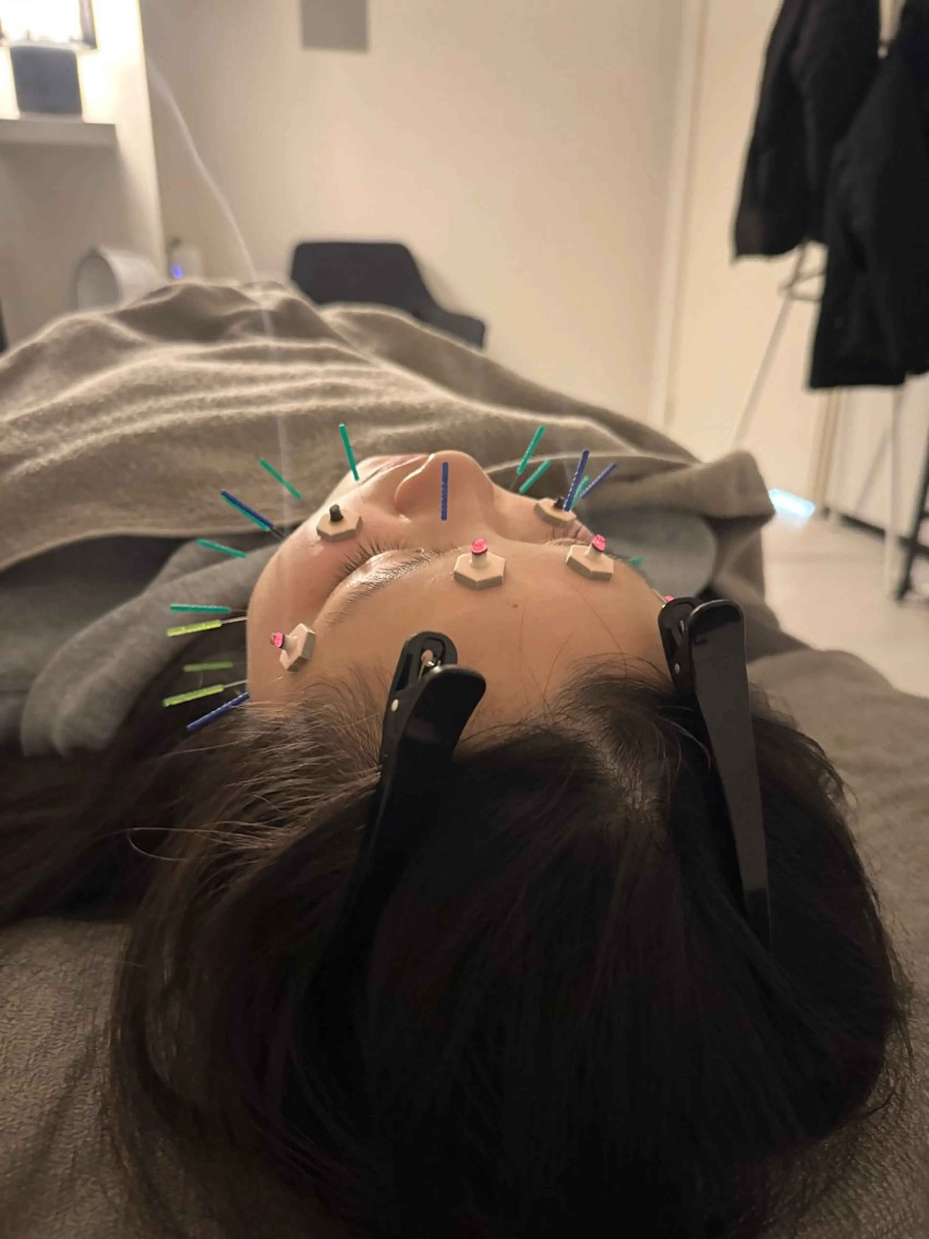 エステ リラク 美容鍼×小顔矯正 ×美容整体　浜川泰仁のエステ・リラクイメージ