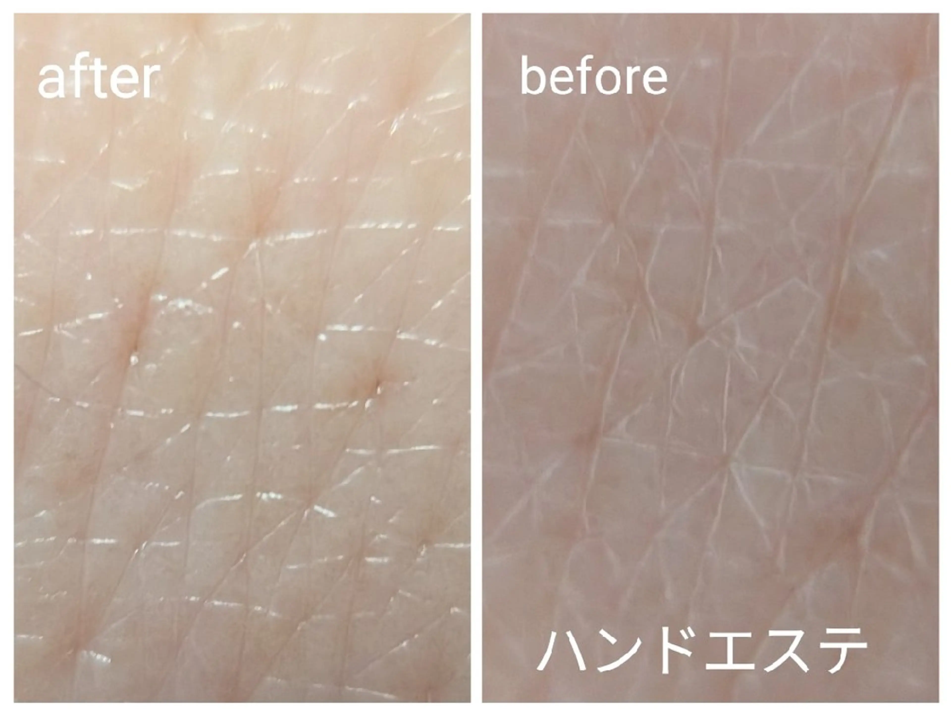 Freesia フリージアのエステ・リラクイメージ