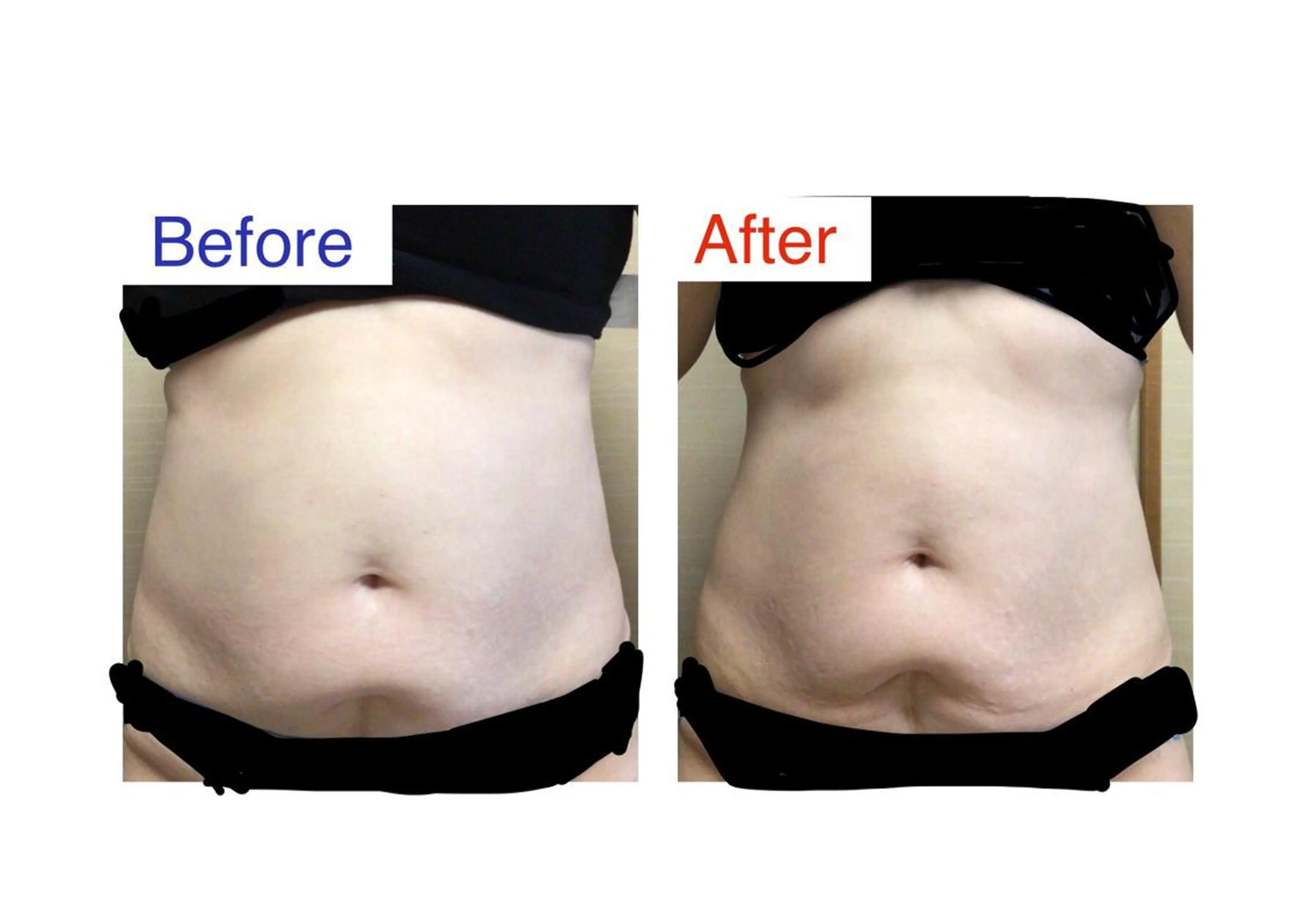 子宮矯正/腸揉み/ シュガーリング脱毛のエステ・リラクイメージ