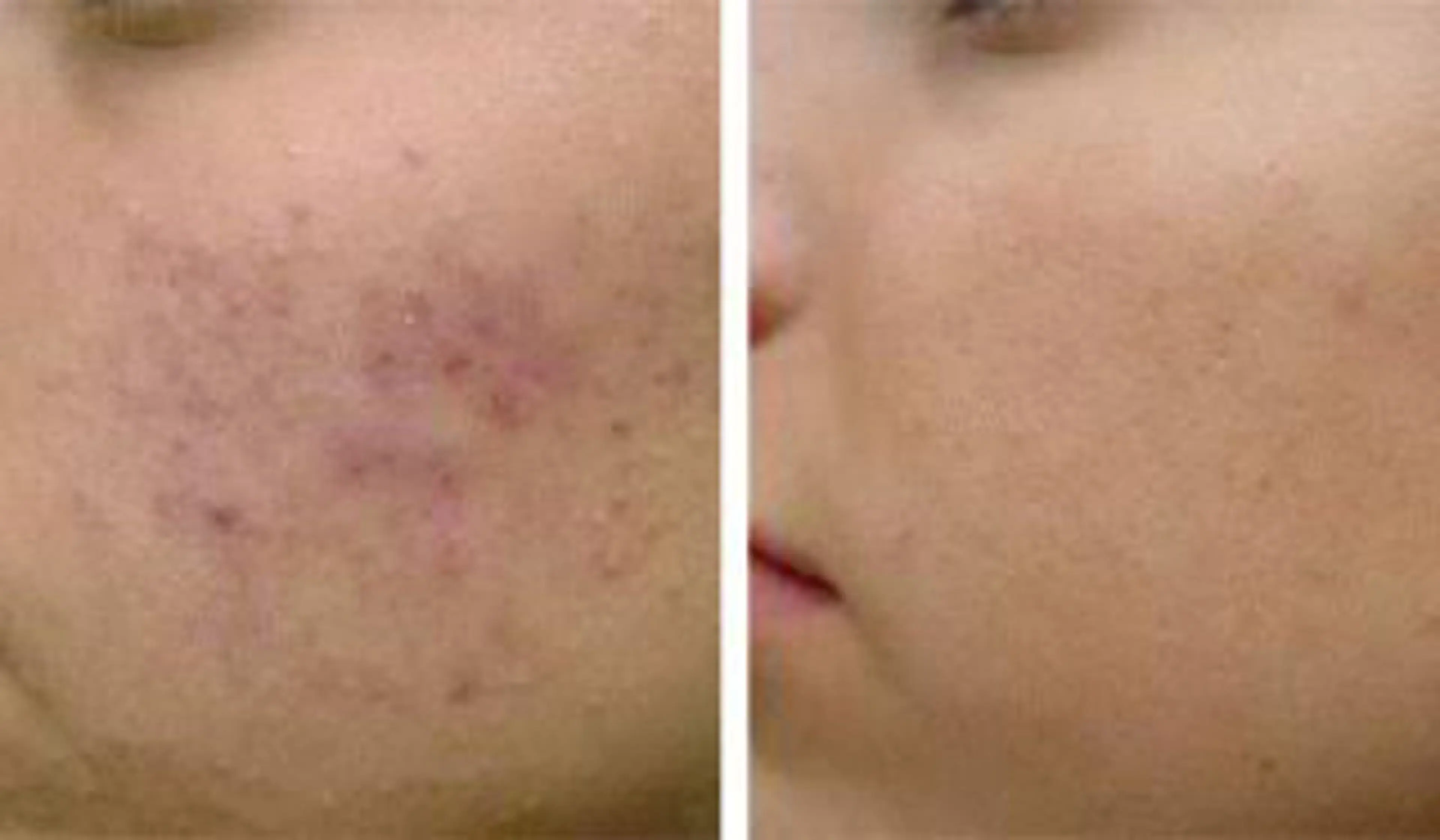 エステサロン オルガスタイルのエステ・リラクイメージ