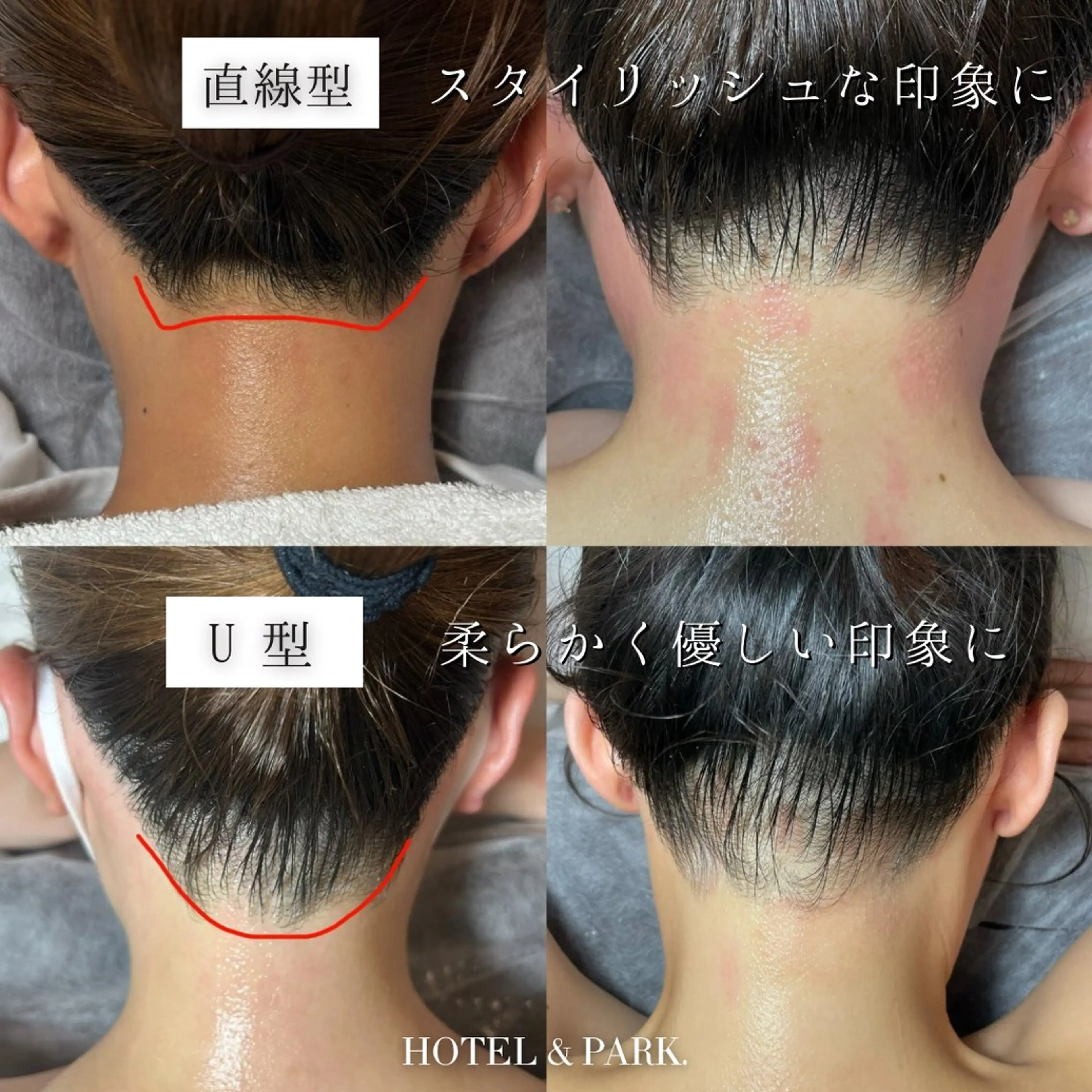 HOTEL&PARK . ワックス脱毛のエステ・リラクイメージ