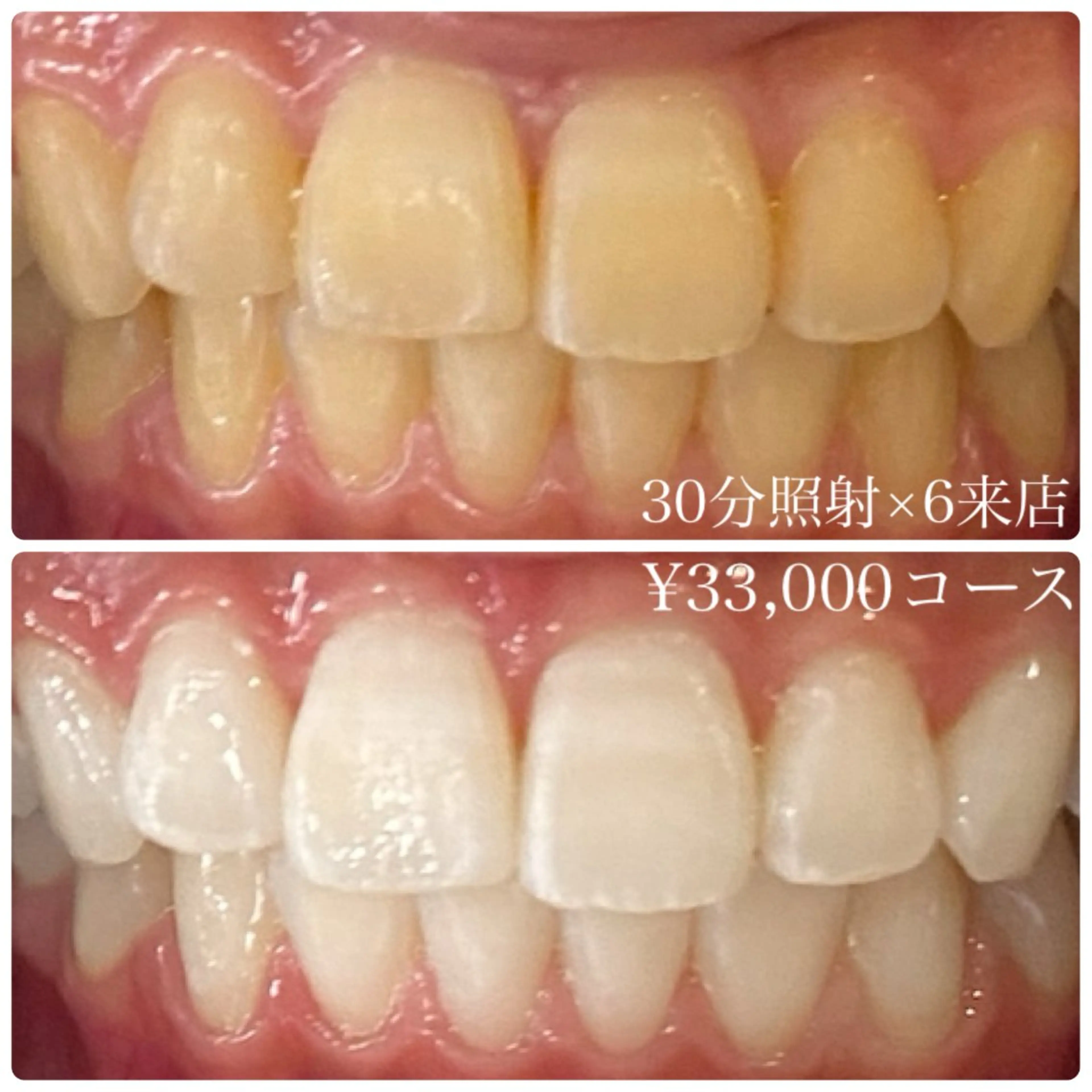 メンズ その他 ホワイトニング ルーム　川崎店のその他イメージ