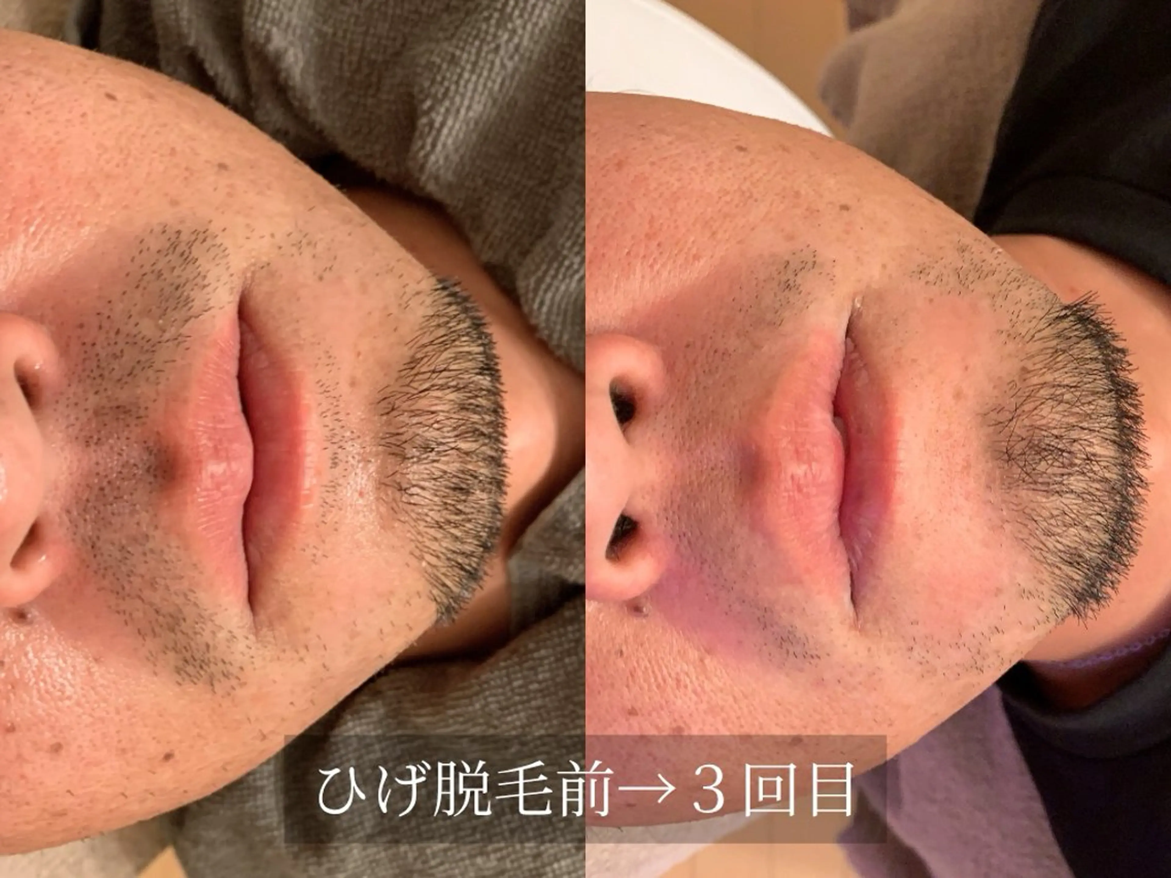 脱毛サロン Arumのエステ・リラクイメージ