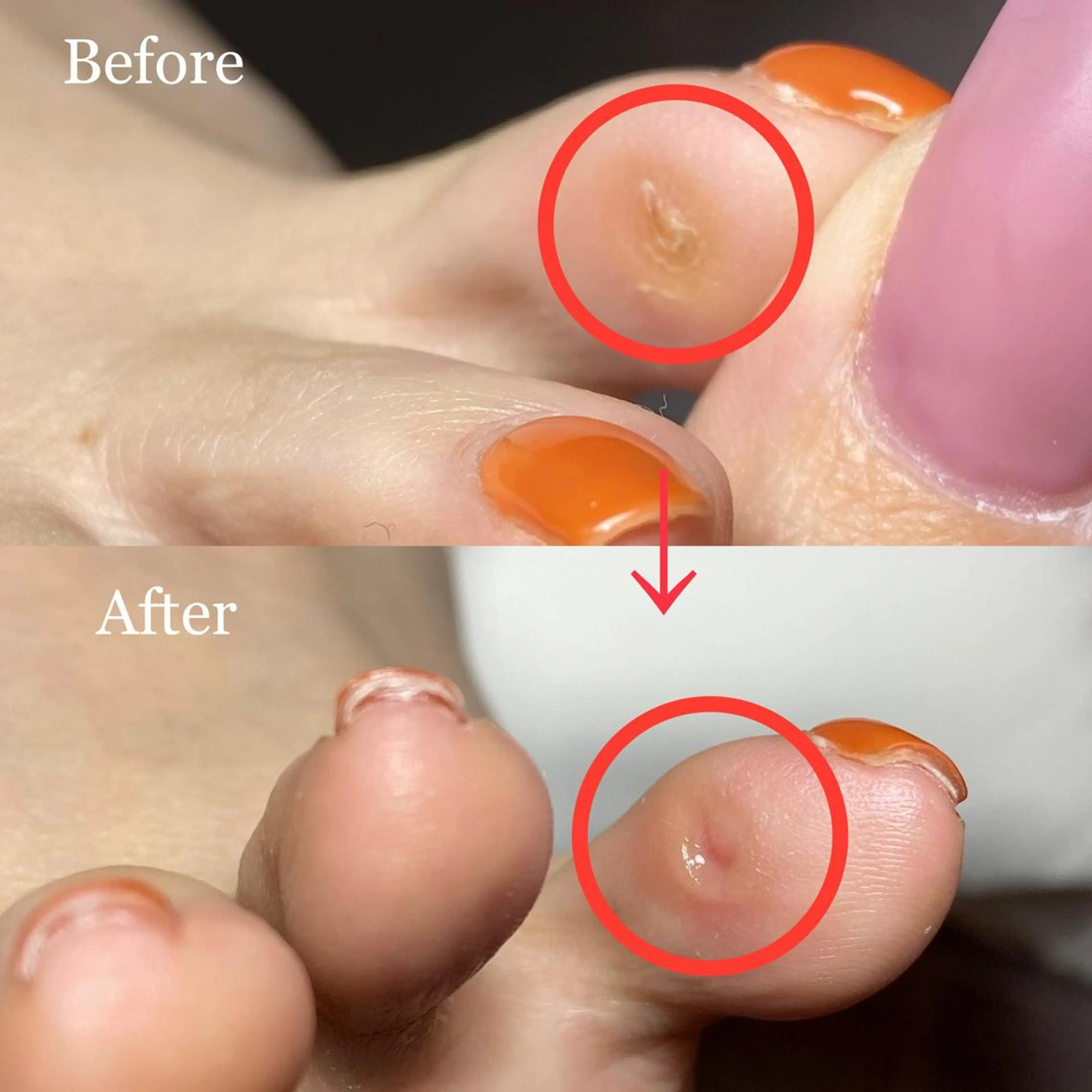 ネイル 長さ出し フットネイル ジェルネイル NailTailor ネイルテイラーのネイルデザイン