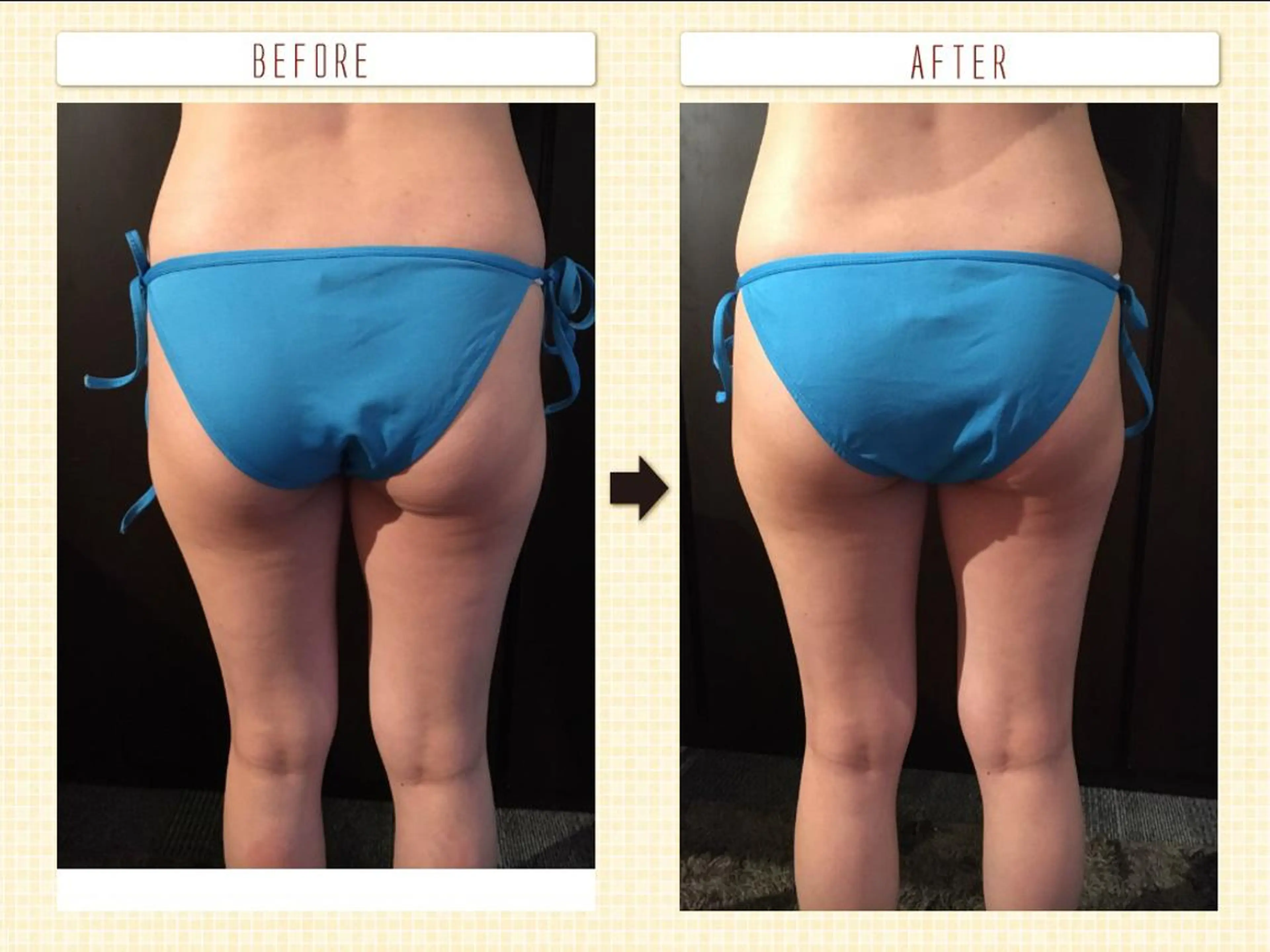 A.mstic 美肌、美ボディ専門店のエステ・リラクイメージ