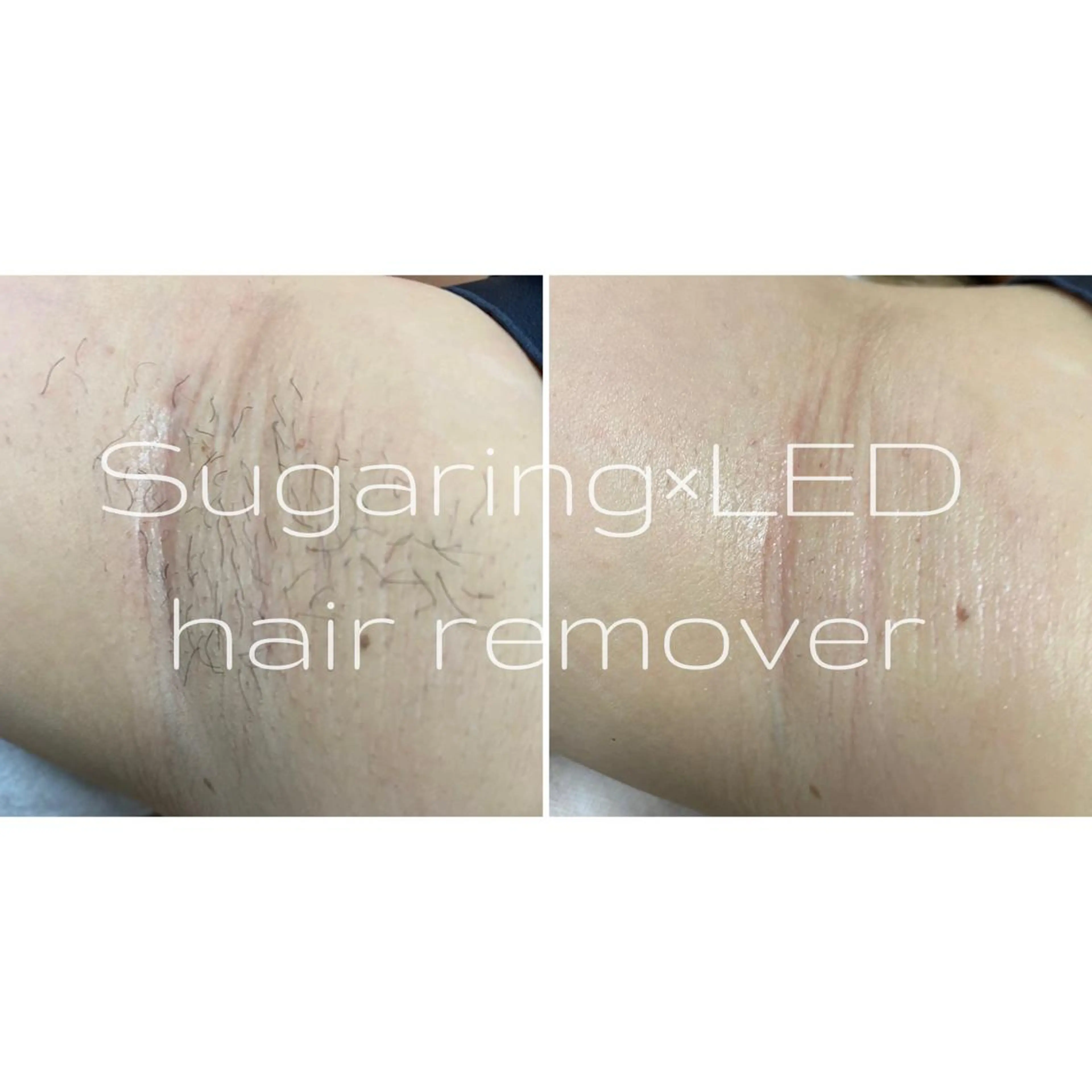 Sugaring / HILOT TAOのエステ・リラクイメージ