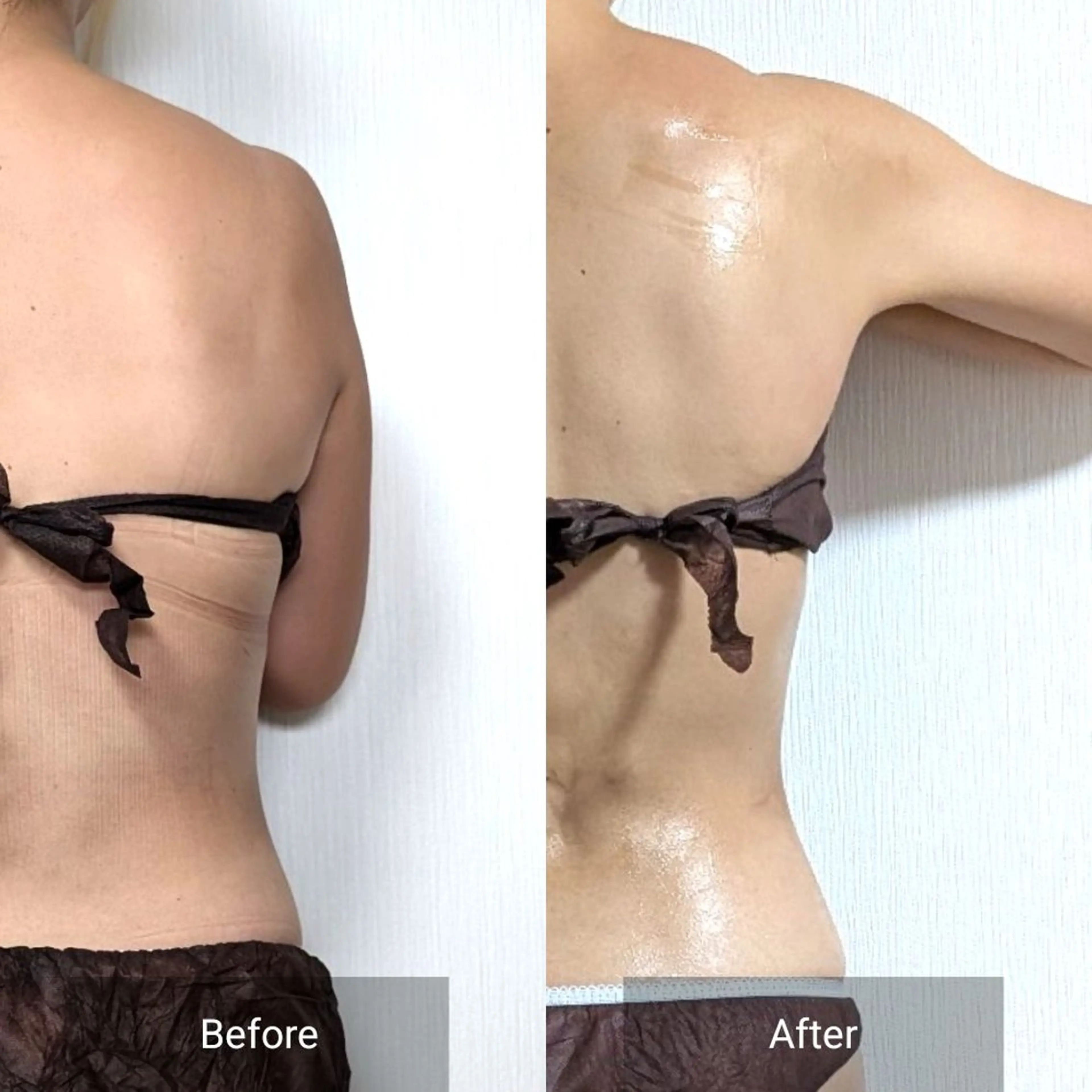 エステ nail RiRi アトレナチュラのエステ・リラクイメージ