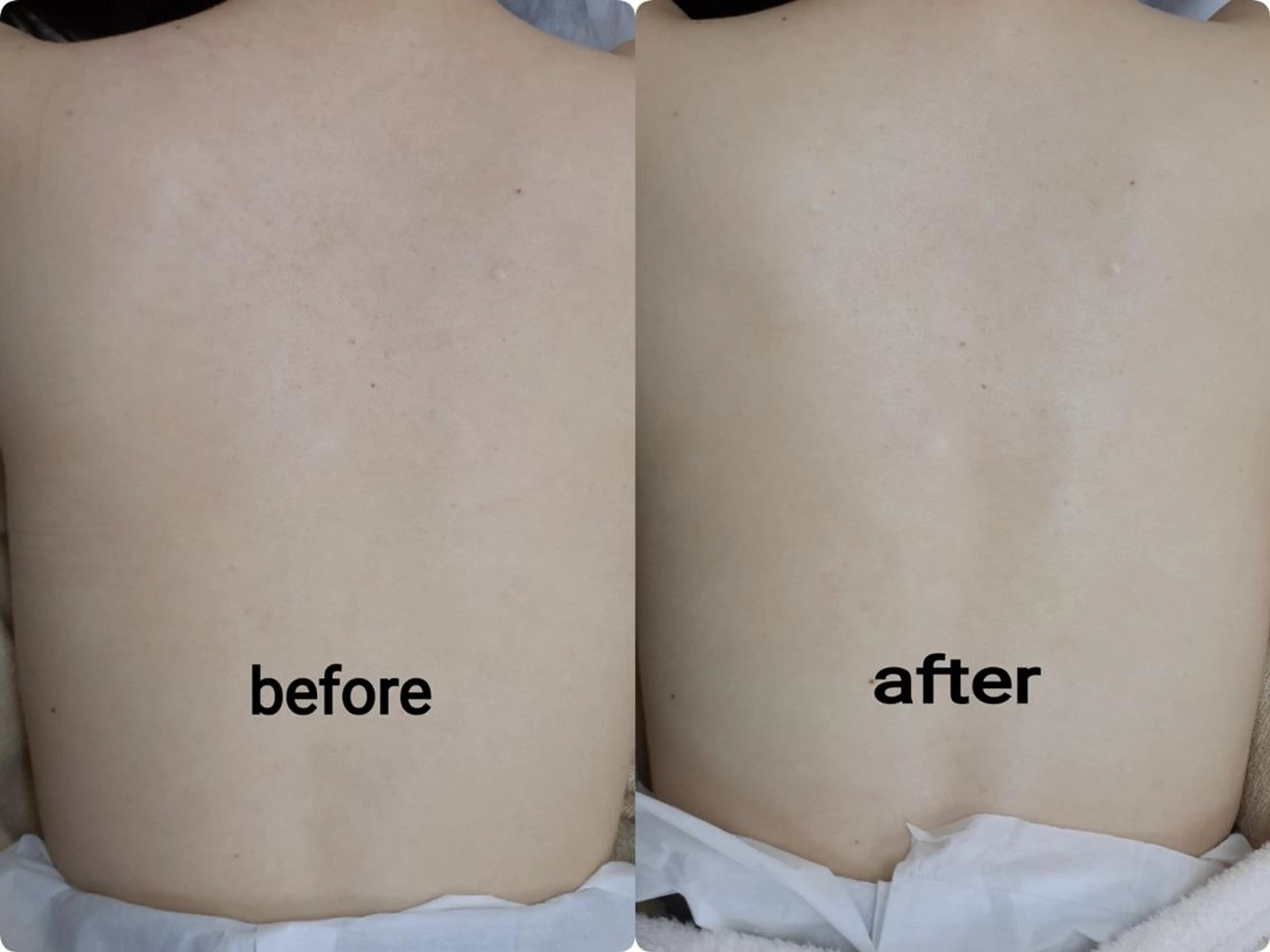 肌ケア＆毛穴洗浄 Cheri/女性専用のエステ・リラクイメージ