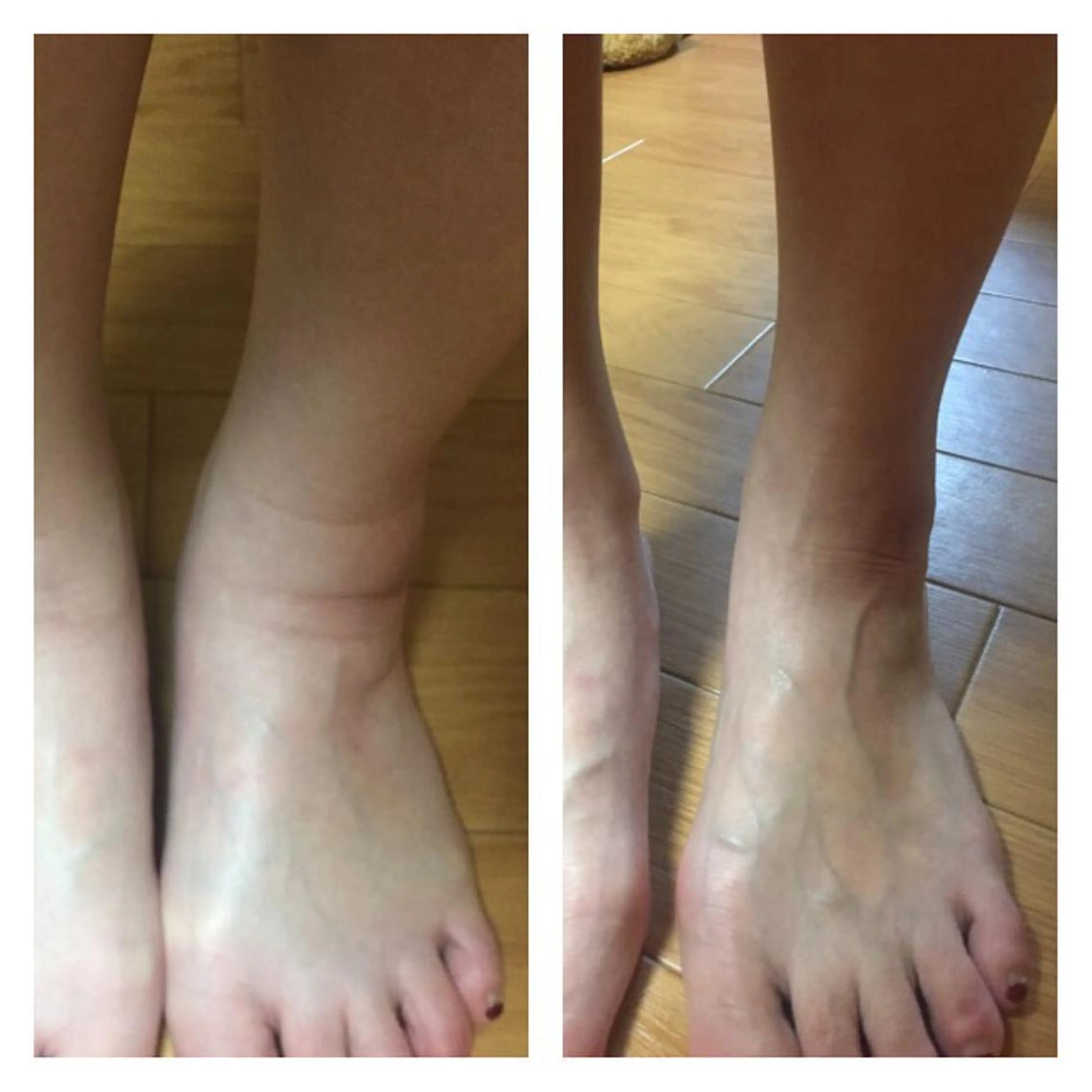 HappIness 遠赤外線ドームのエステ・リラクイメージ