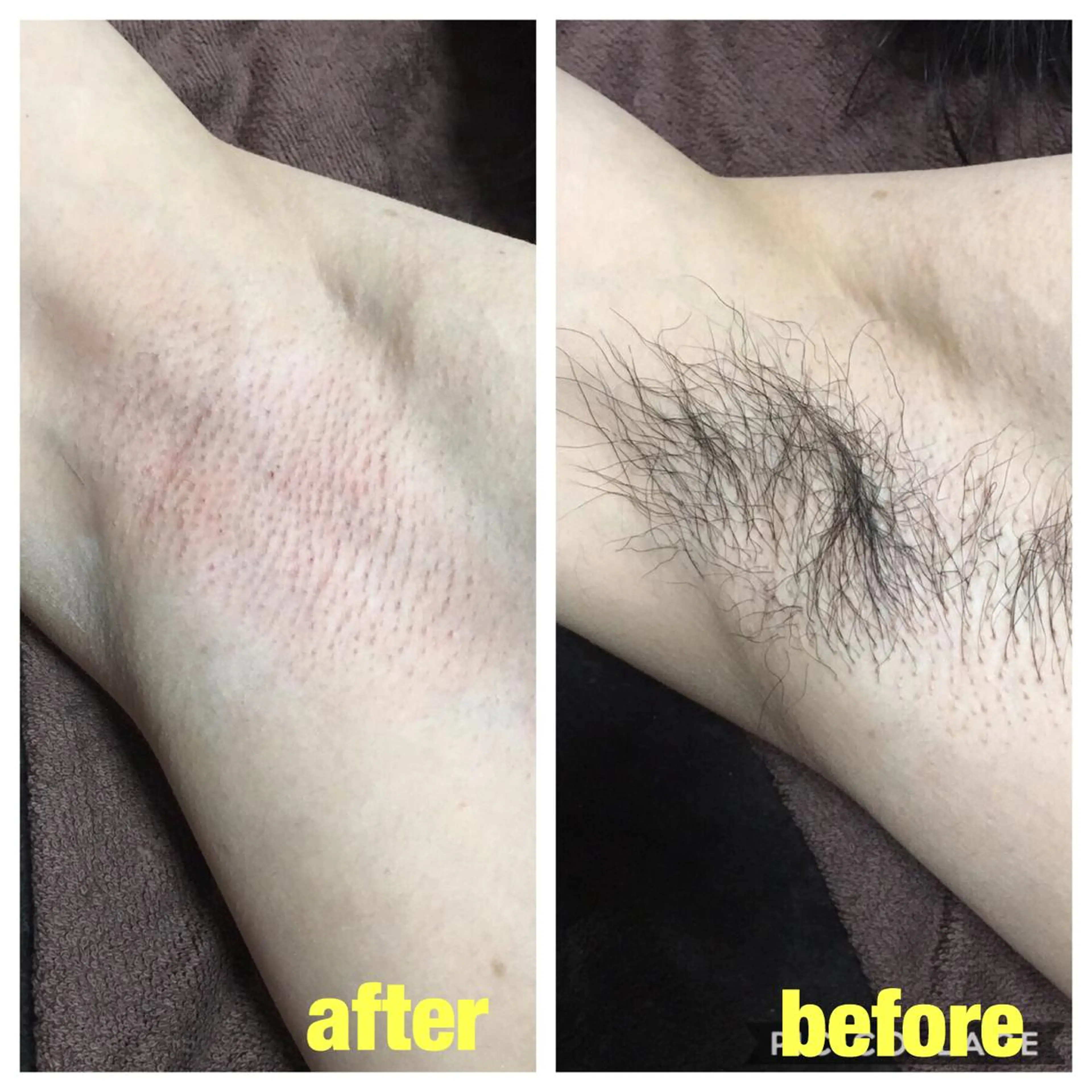 プライベートサロン belleのエステ・リラクイメージ