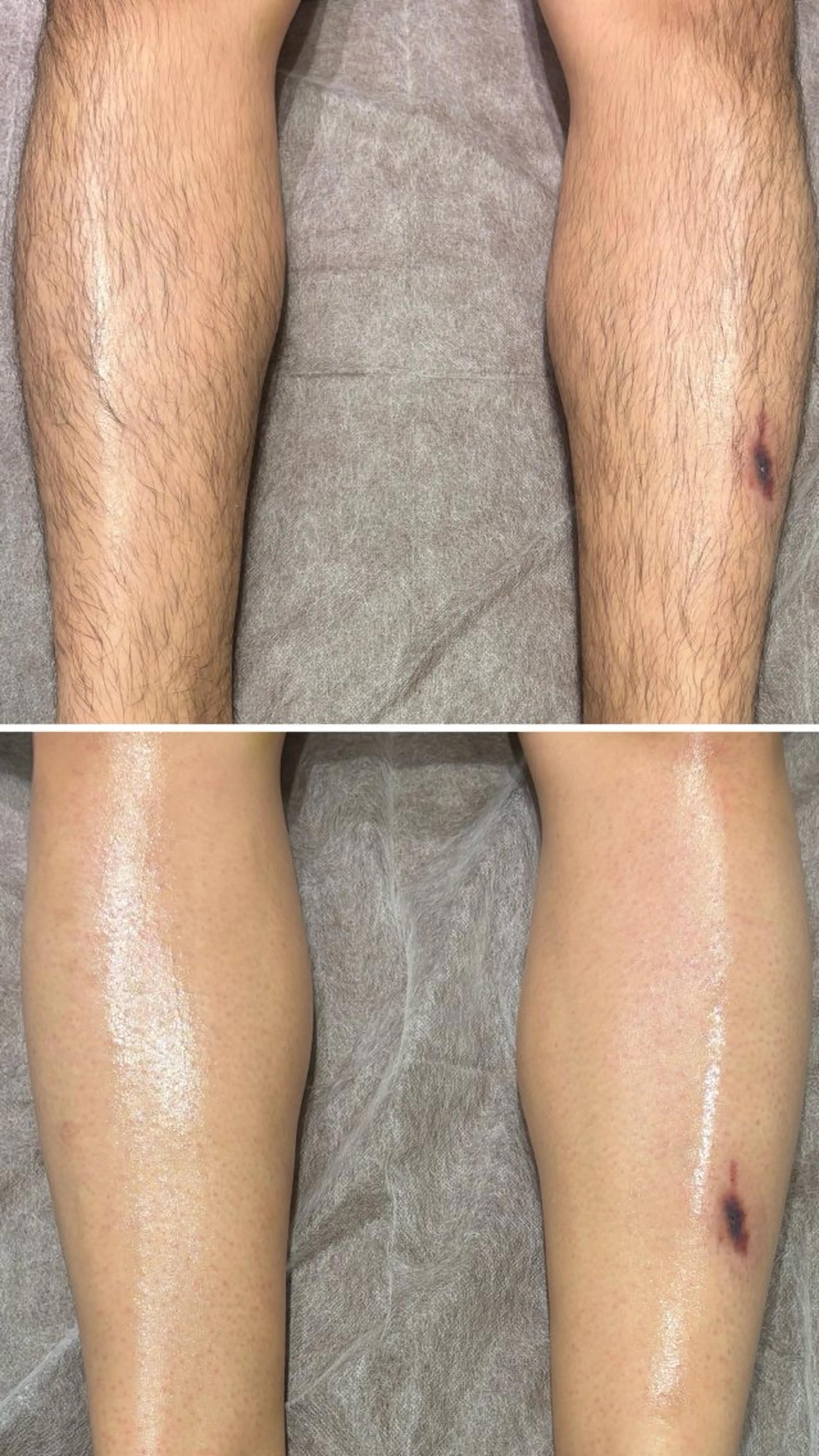 メンズ エステ 肌質改善◇結果重視 美麗-MIREI-のエステ・リラクイメージ