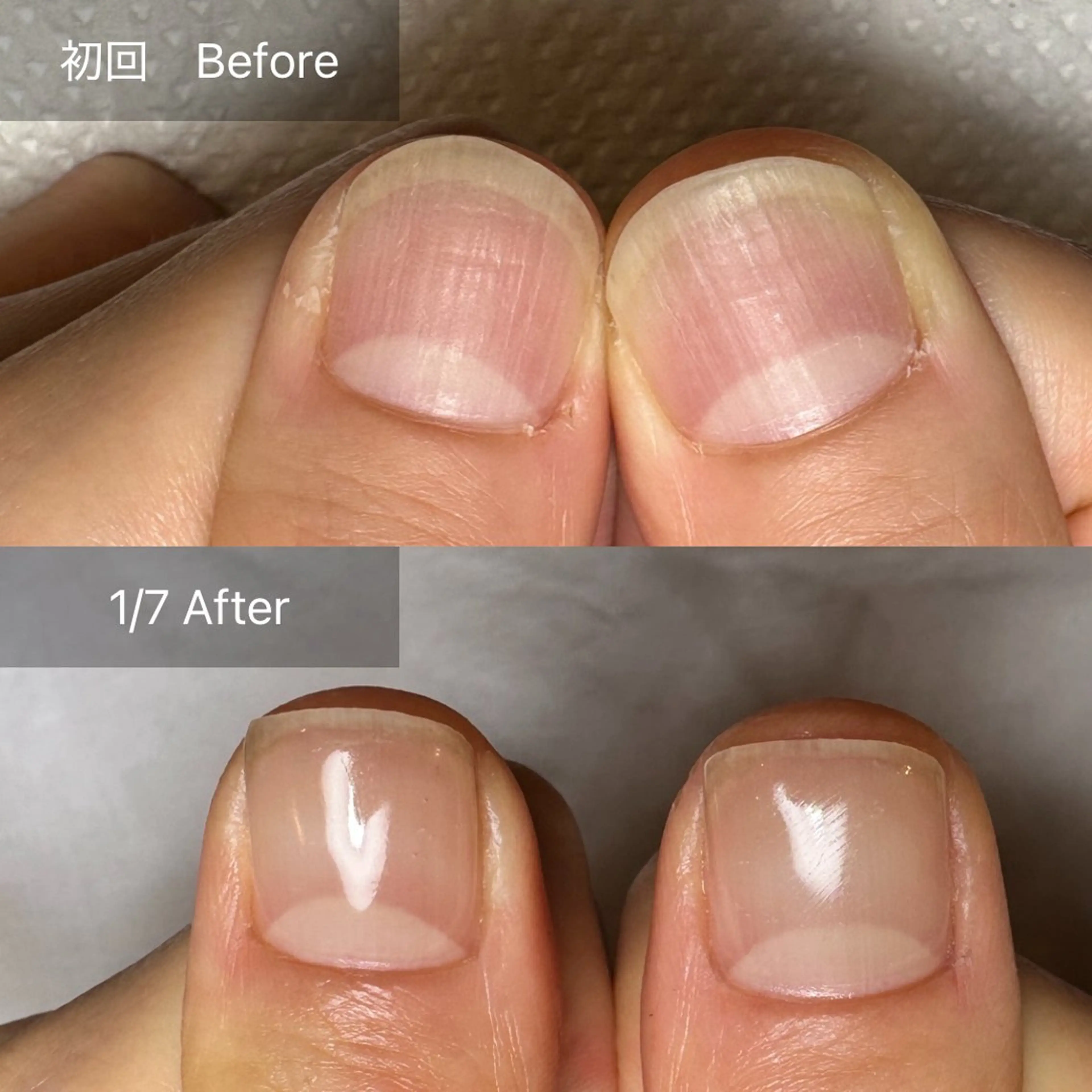 ネイル 木村 千晴のネイルデザイン