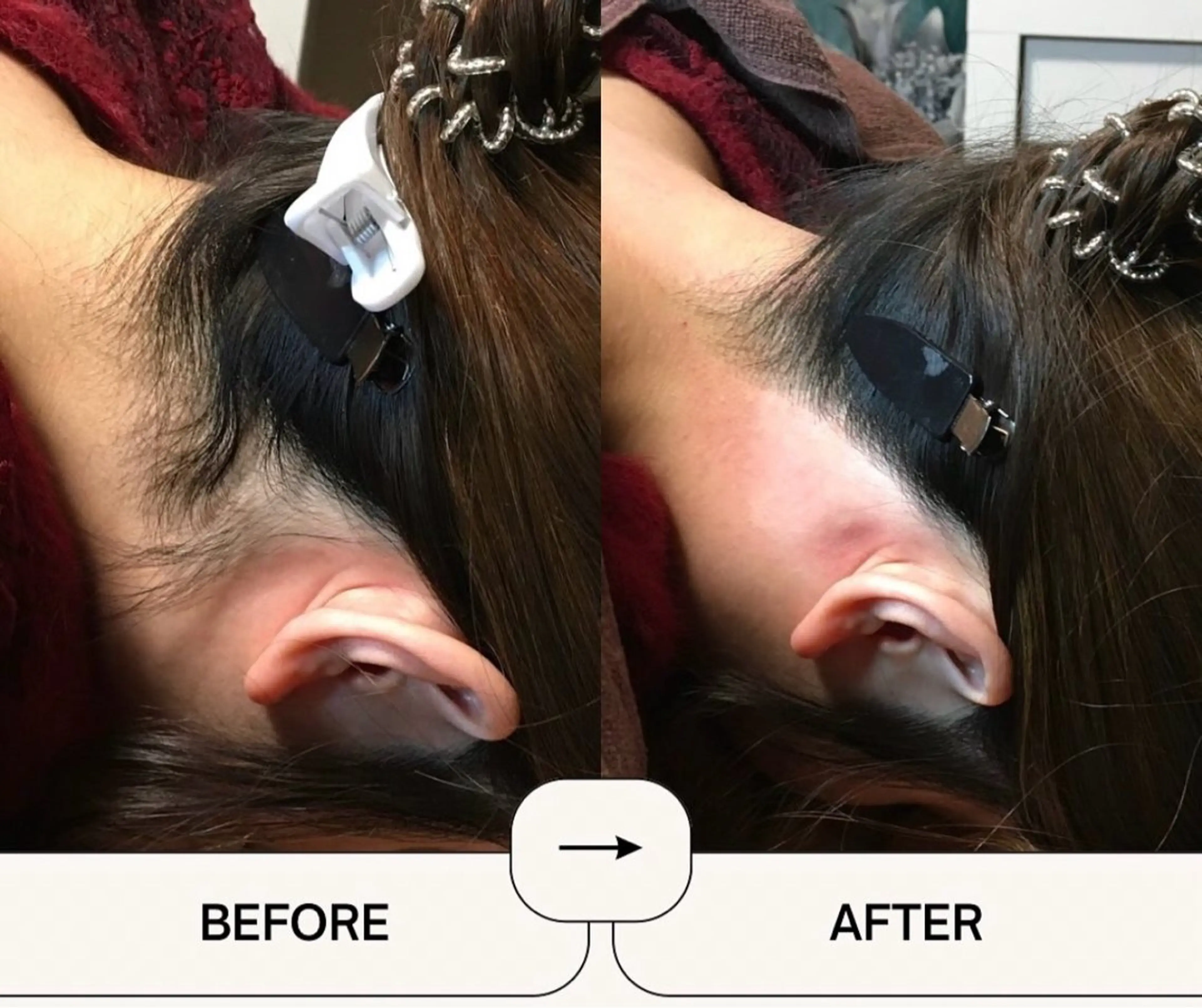 脱毛 シュガーリスト Nanaのエステ・リラクイメージ